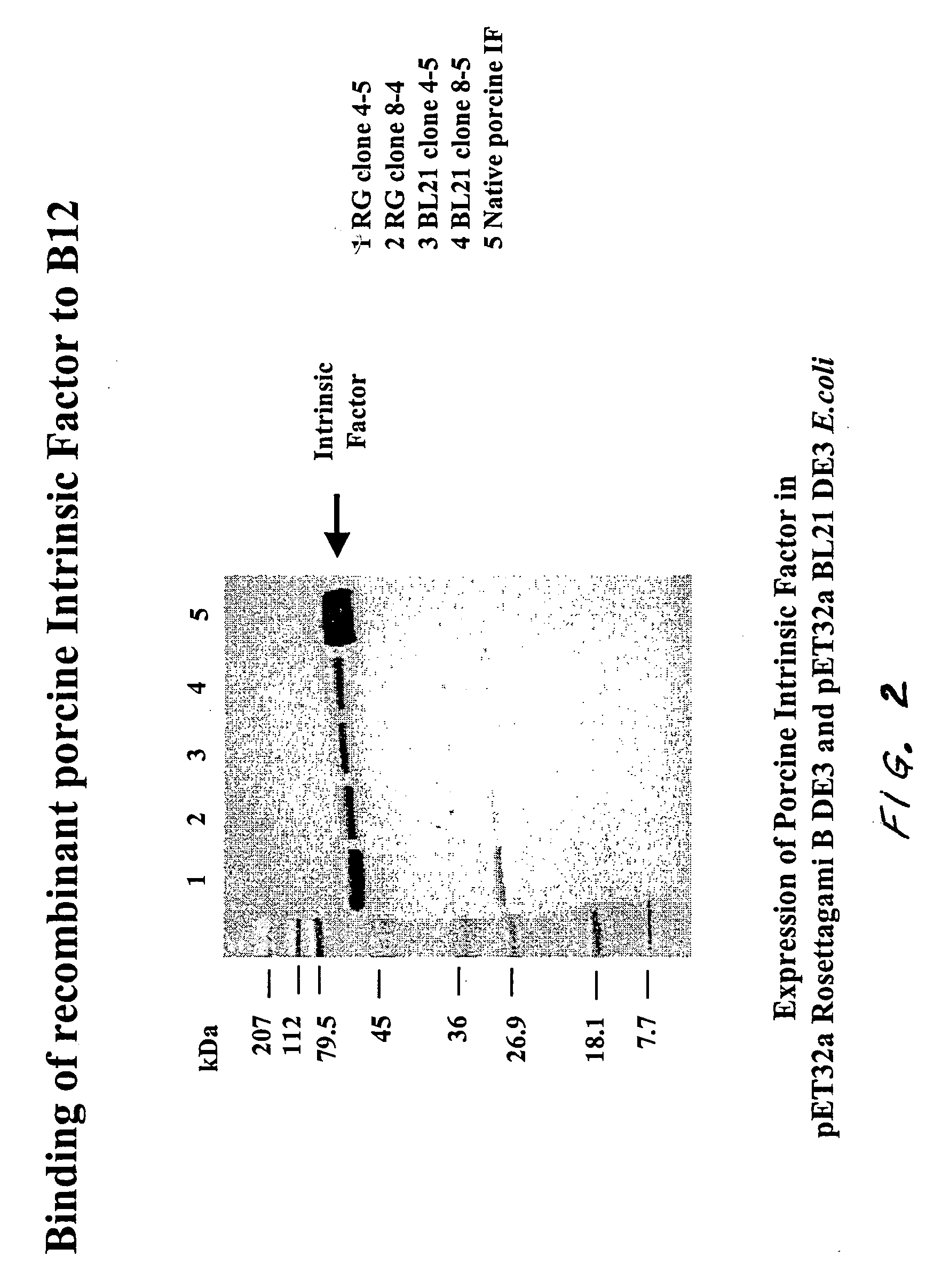 Diagnostic test for vitamin B12