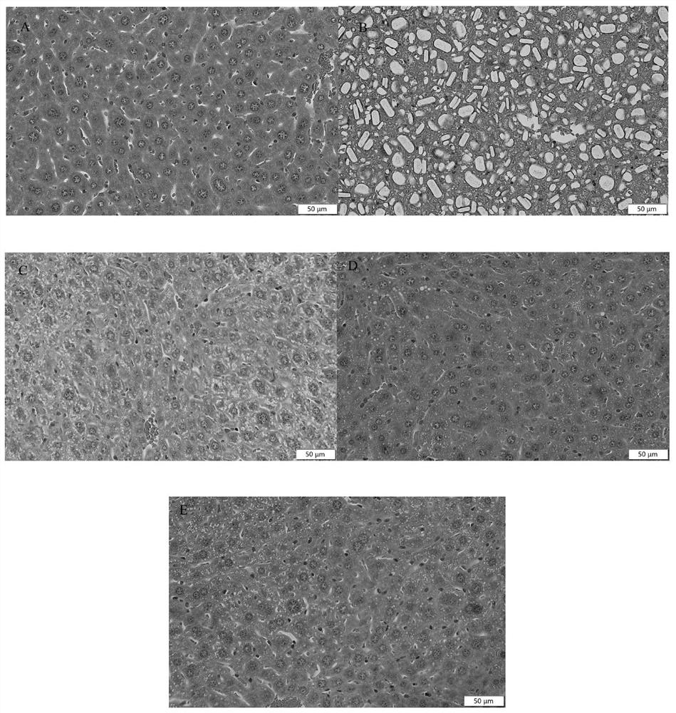 Angelica sinensis fermentation liquor with effects of resisting oxidation, resisting aging and regulating intestinal flora as well as preparation method and application thereof