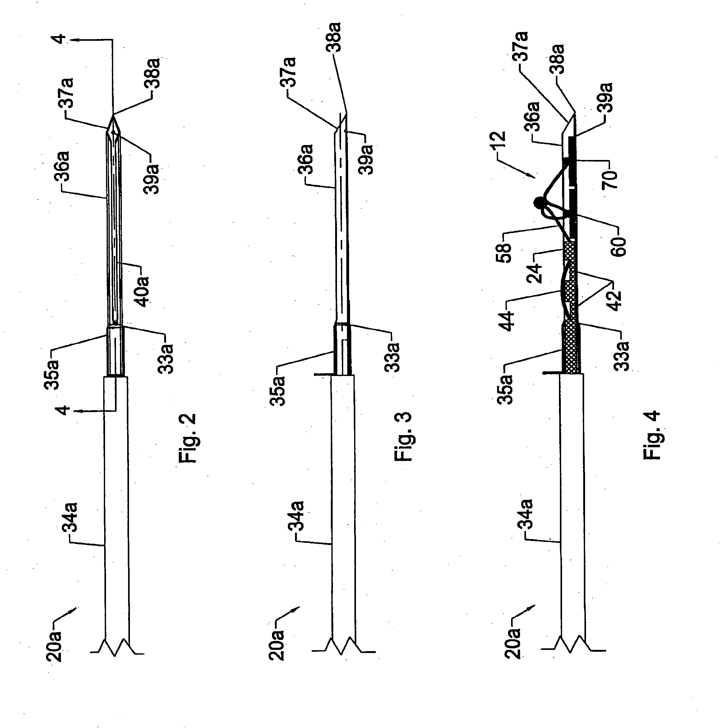 System and method for all-inside suture fixation for implant attachment and soft tissue repair