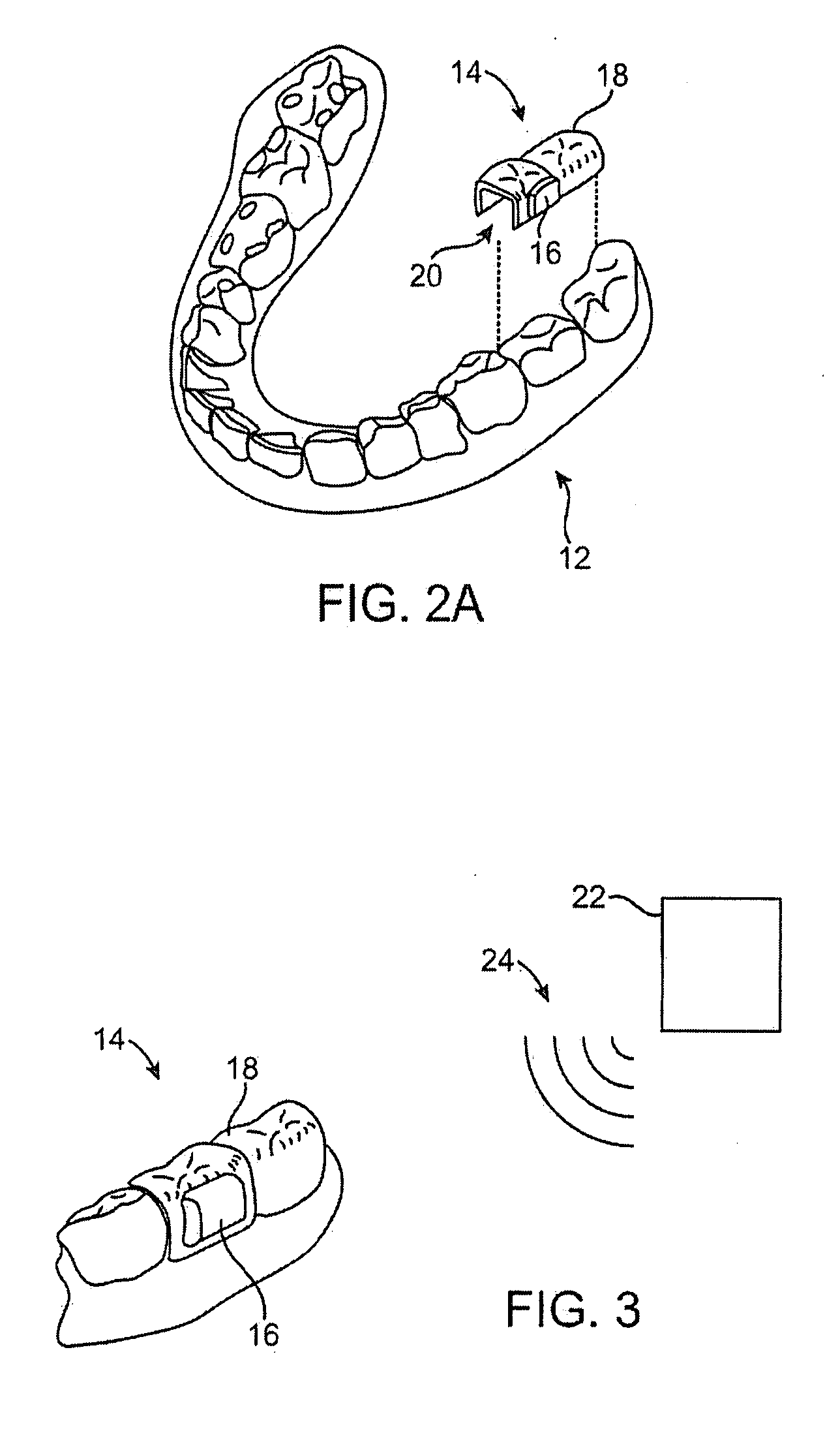 Methods and apparatus for transmitting vibrations