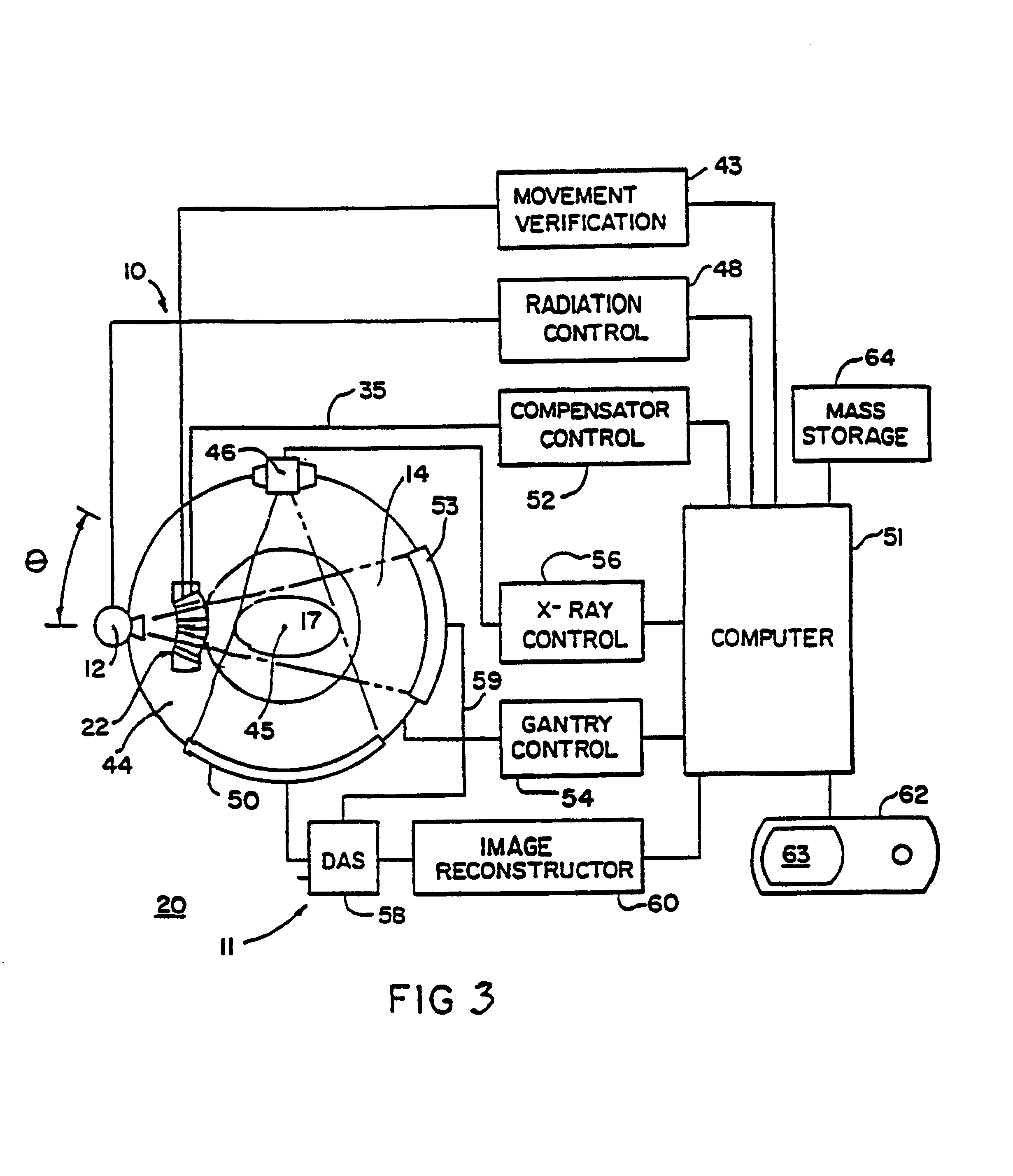 Method for preparing a radiation therapy plan
