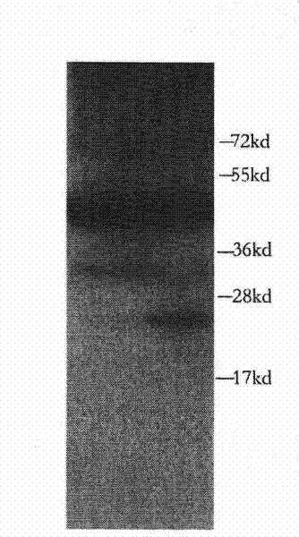 Polypeptide for preparing anti-PINK1 polyclonal antiserum and application thereof