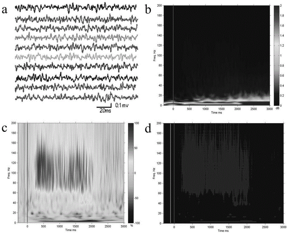 An individualized brain function mapping method based on cortical EEG high-frequency gamma neural oscillations