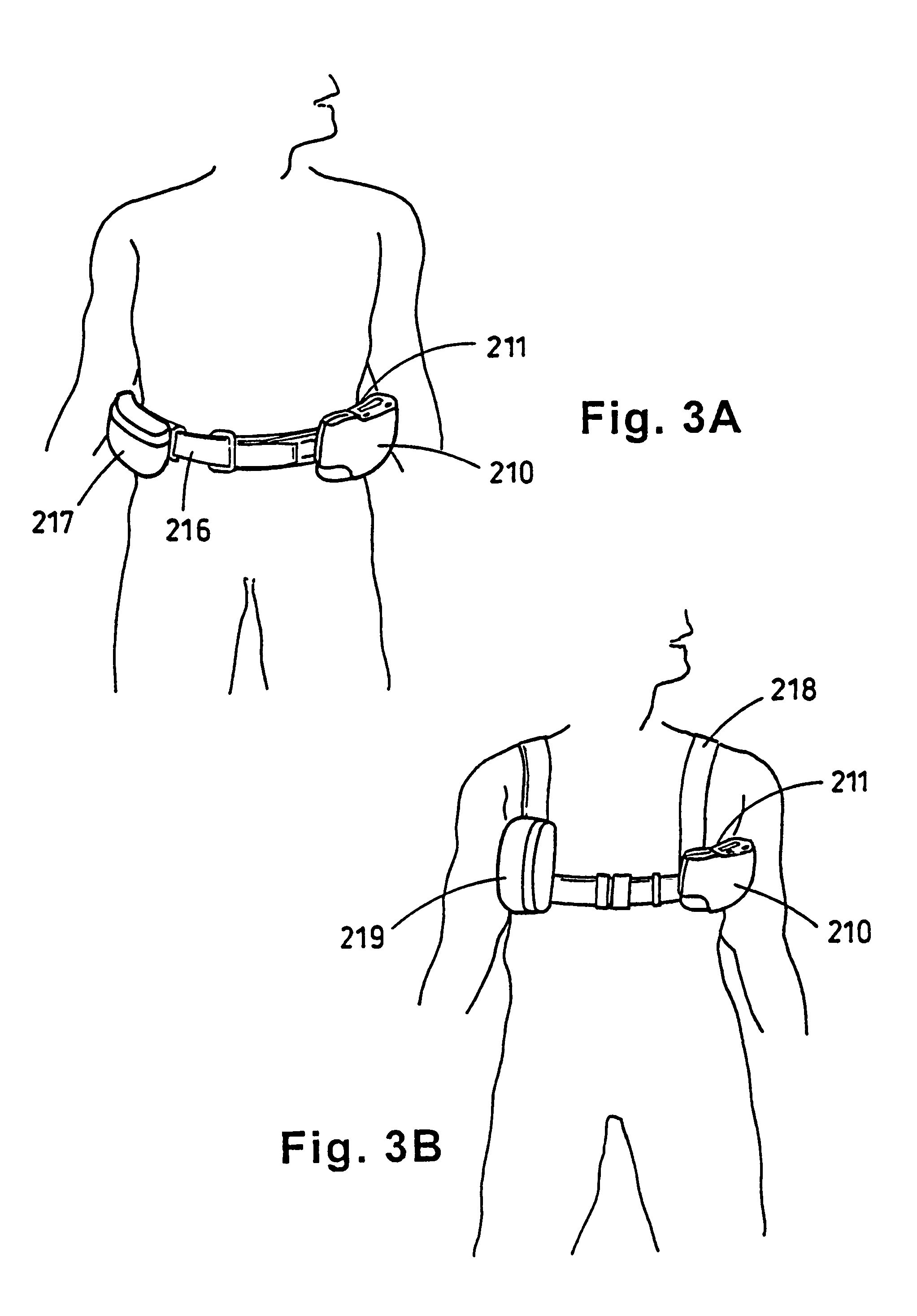 Portable wound treatment apparatus