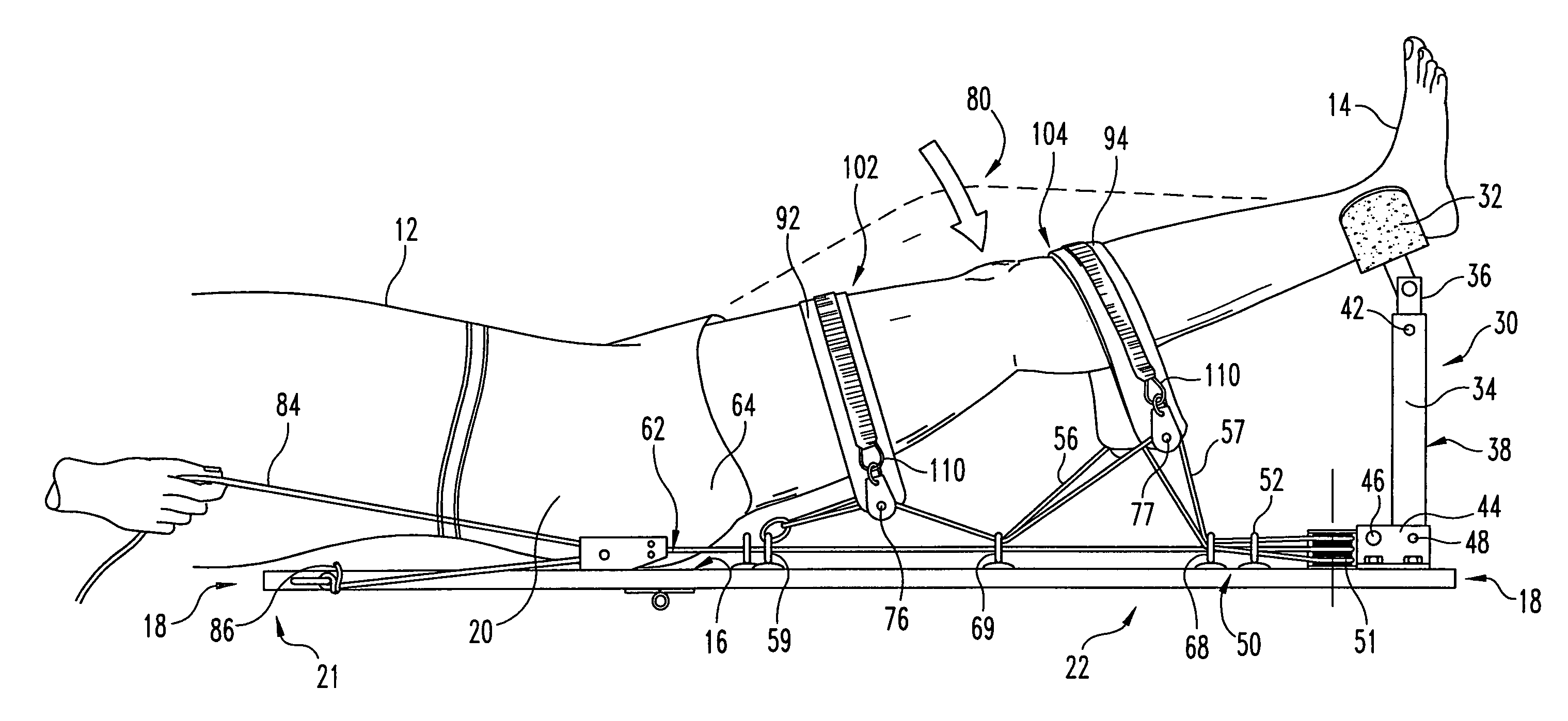 Knee extension therapy apparatus