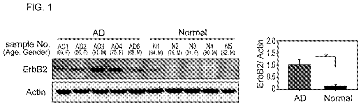 ErbB2 regulates autophagic flux to modulate the proteostasis of APP-CTFs in alzheimer's disease