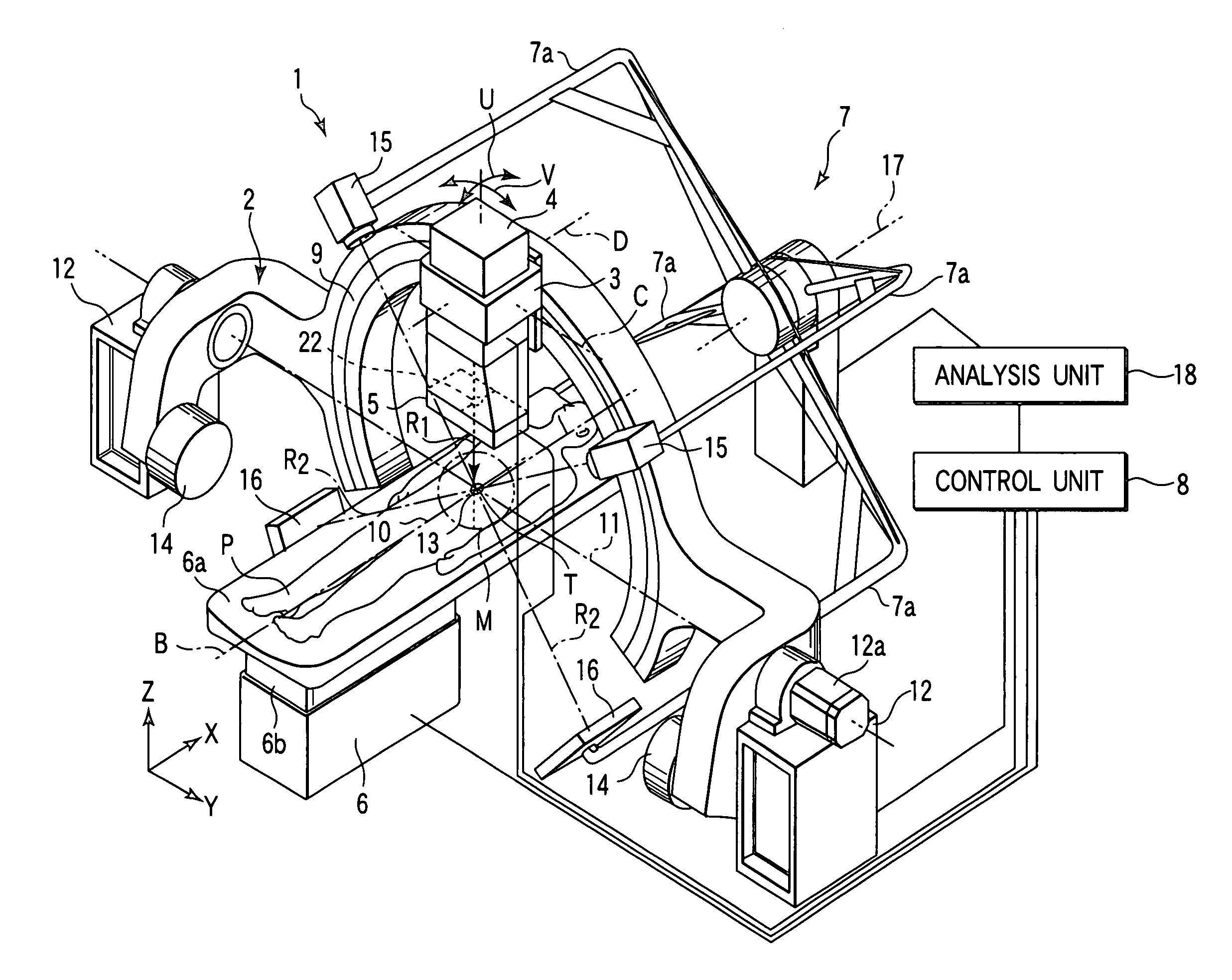 Radiation treatment apparatus