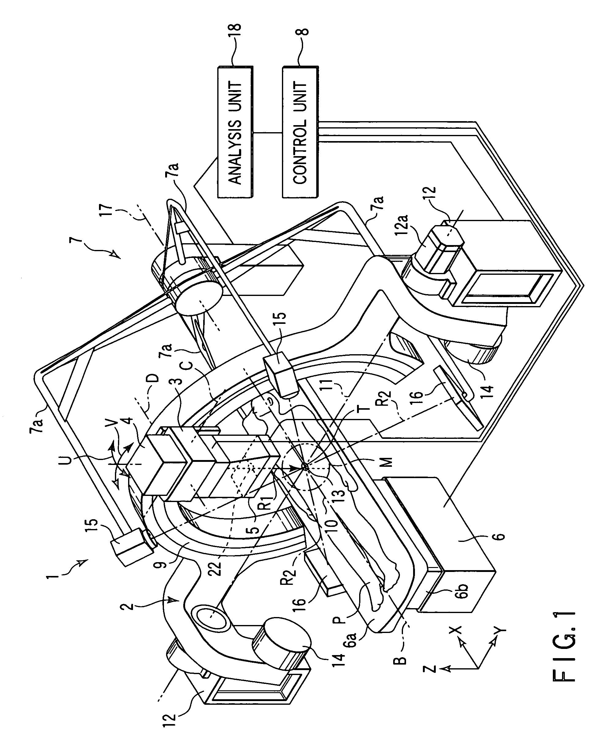 Radiation treatment apparatus