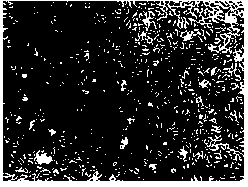 Method for separating endothelial colony-forming cells