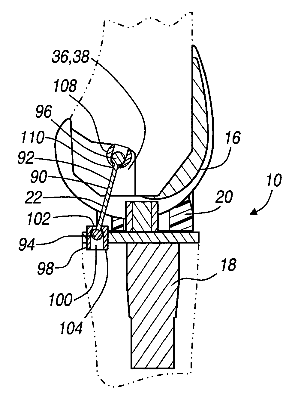 Method and apparatus for mechanically reconstructing ligaments in a knee prosthesis