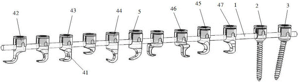 Spine nail rod hook device