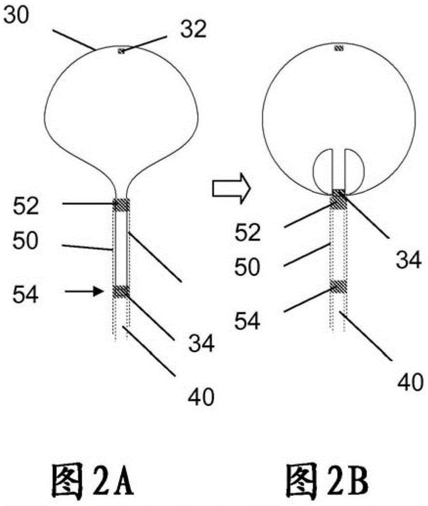 Two-Stage Deployment Aneurysm Embolization Device