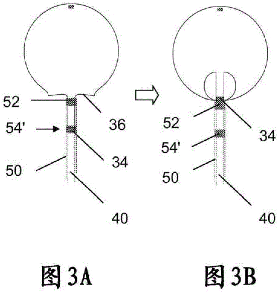 Two-Stage Deployment Aneurysm Embolization Device