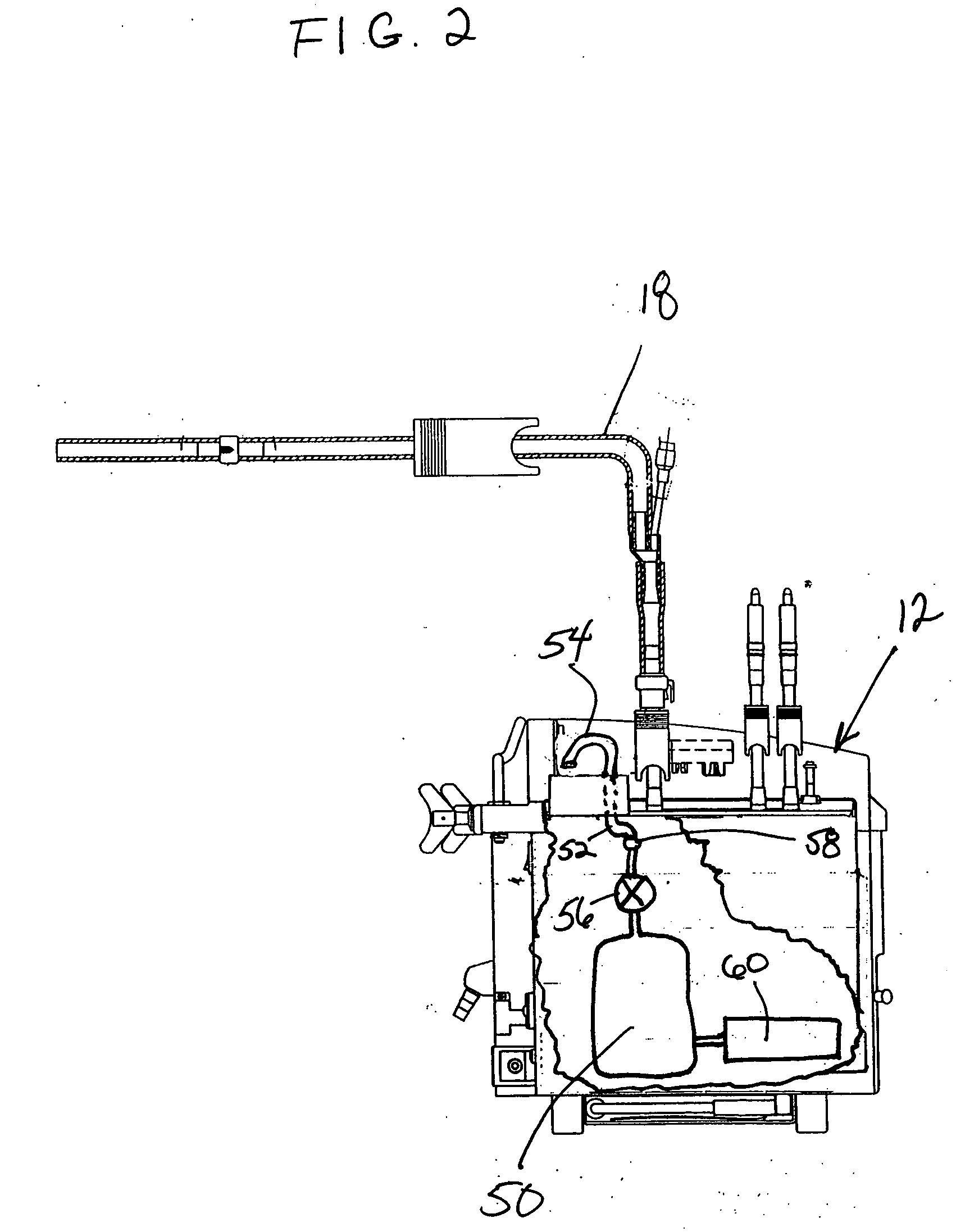 Postoperative fluid monitoring and alert system