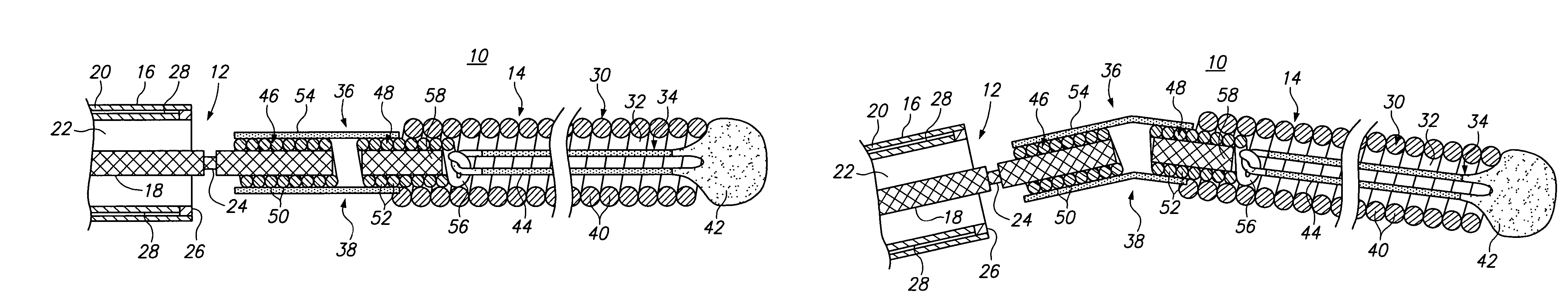 Vaso-occlusive device having pivotable coupling