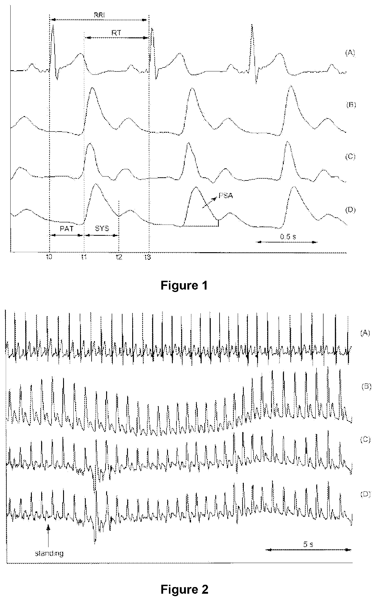 Blood Pressure Calculation Method and Device