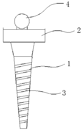 Tooth implant