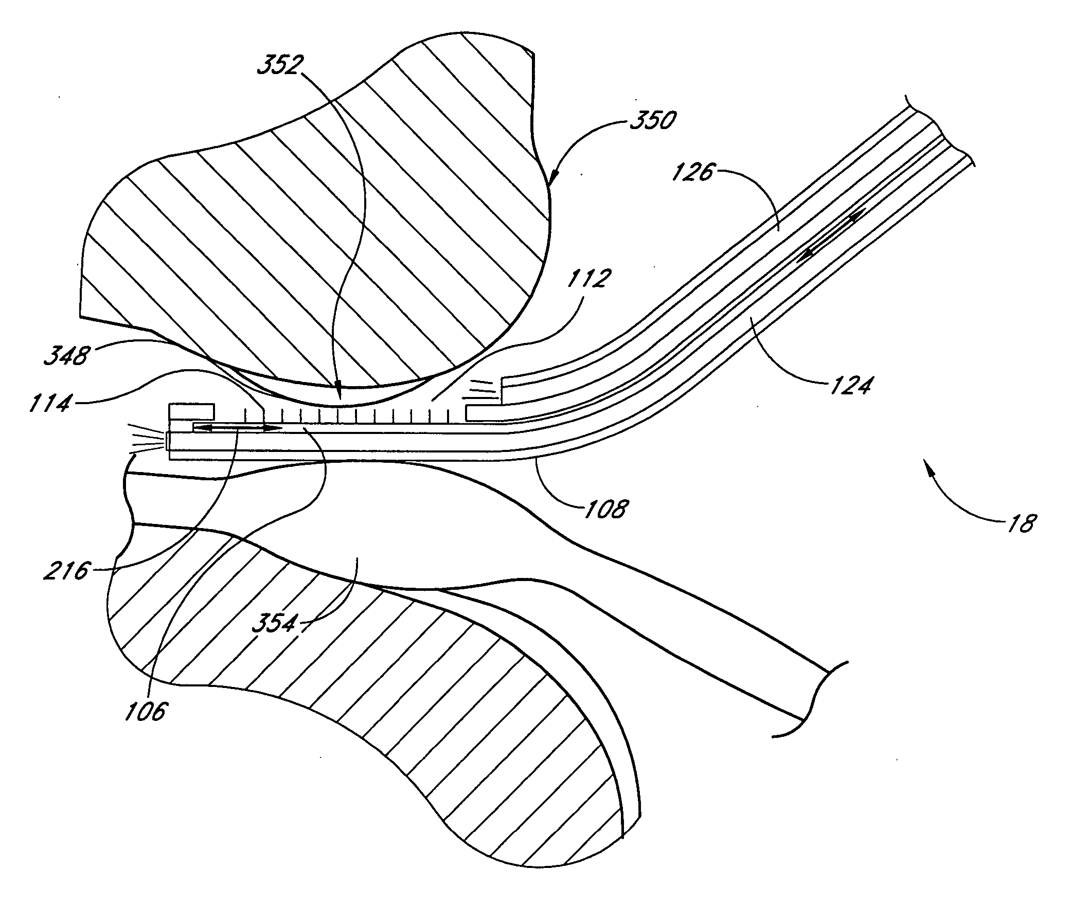 Surgical file instrument