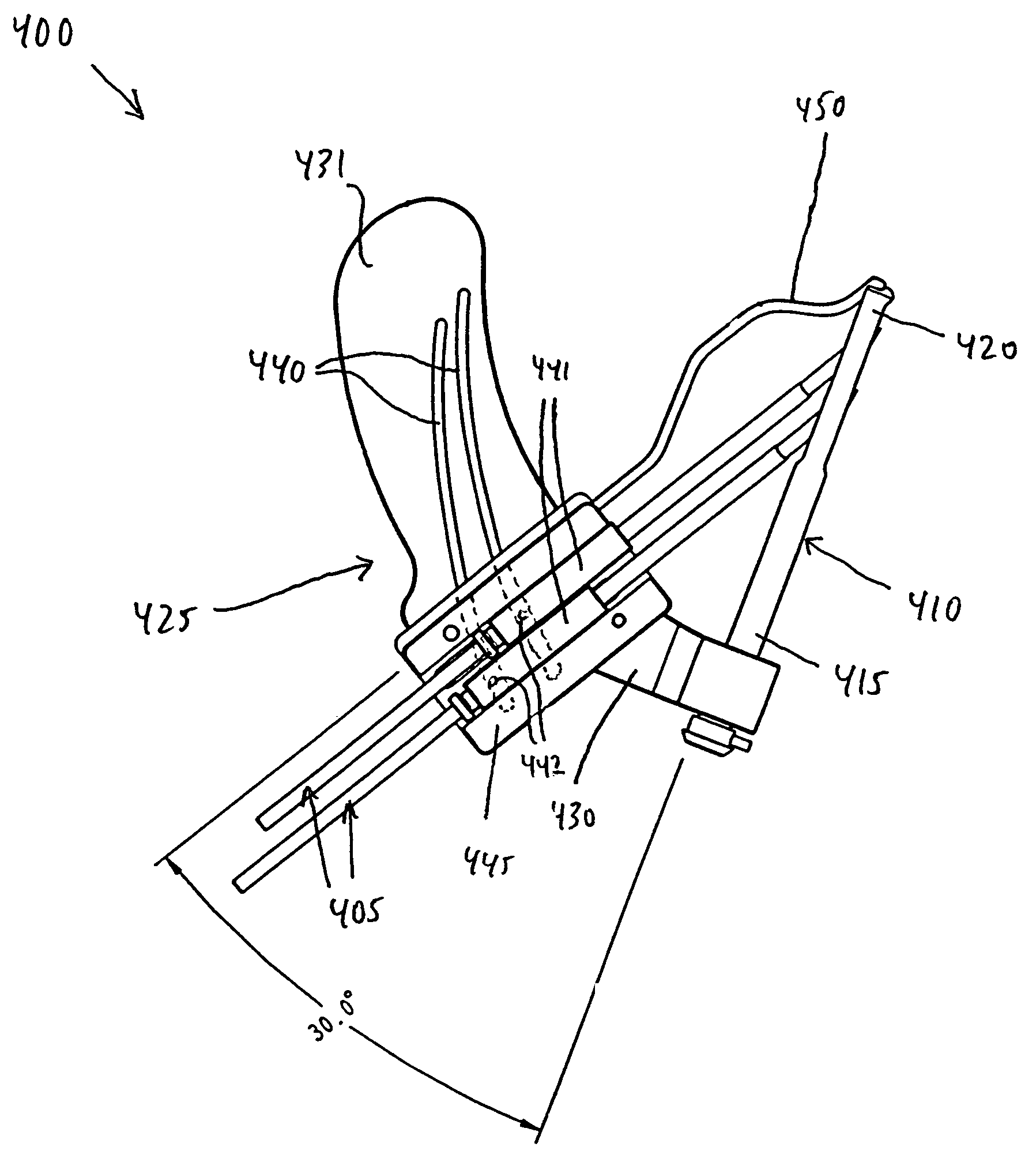 Method and apparatus for fixing a graft in a bone tunnel