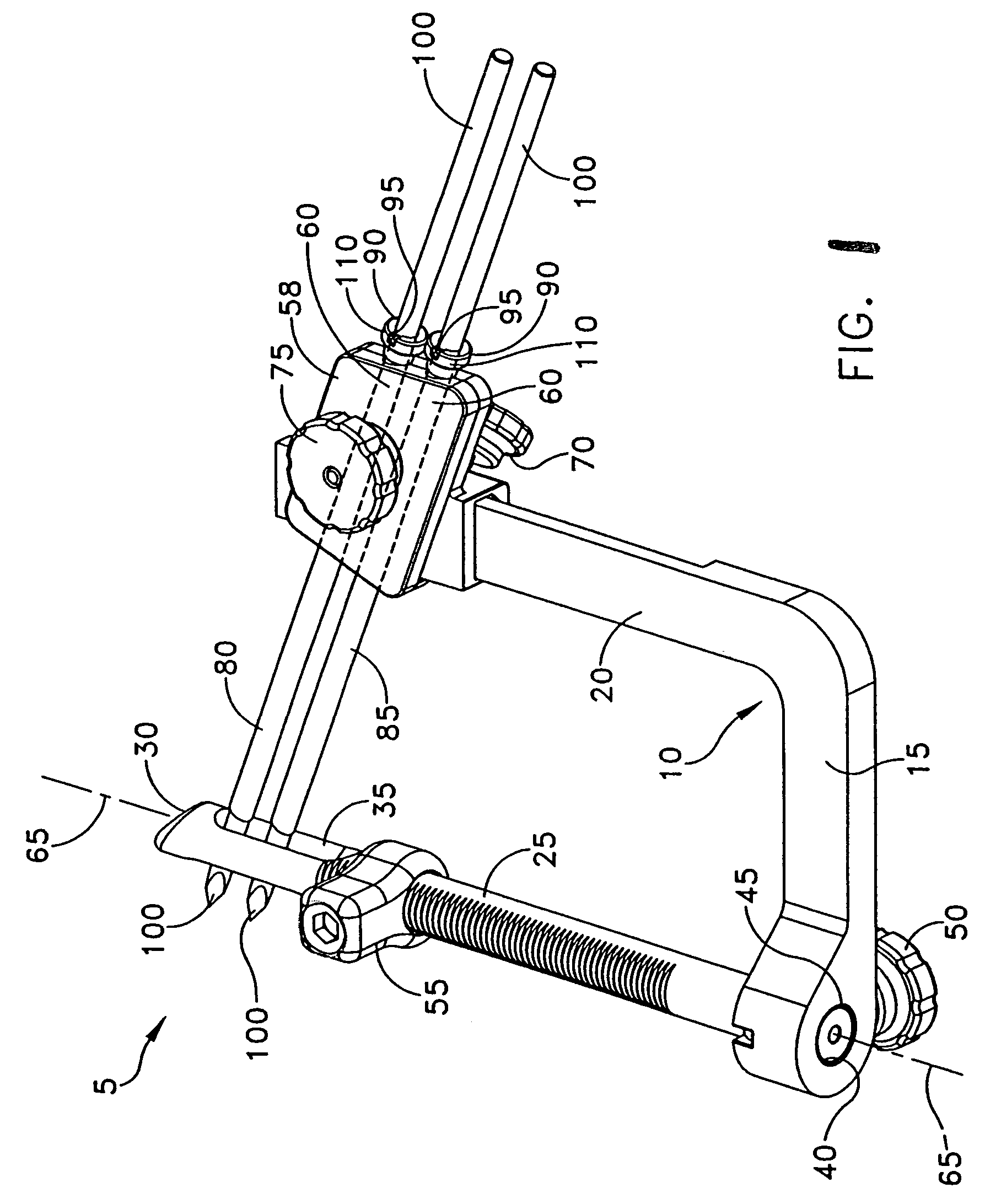 Method and apparatus for fixing a graft in a bone tunnel