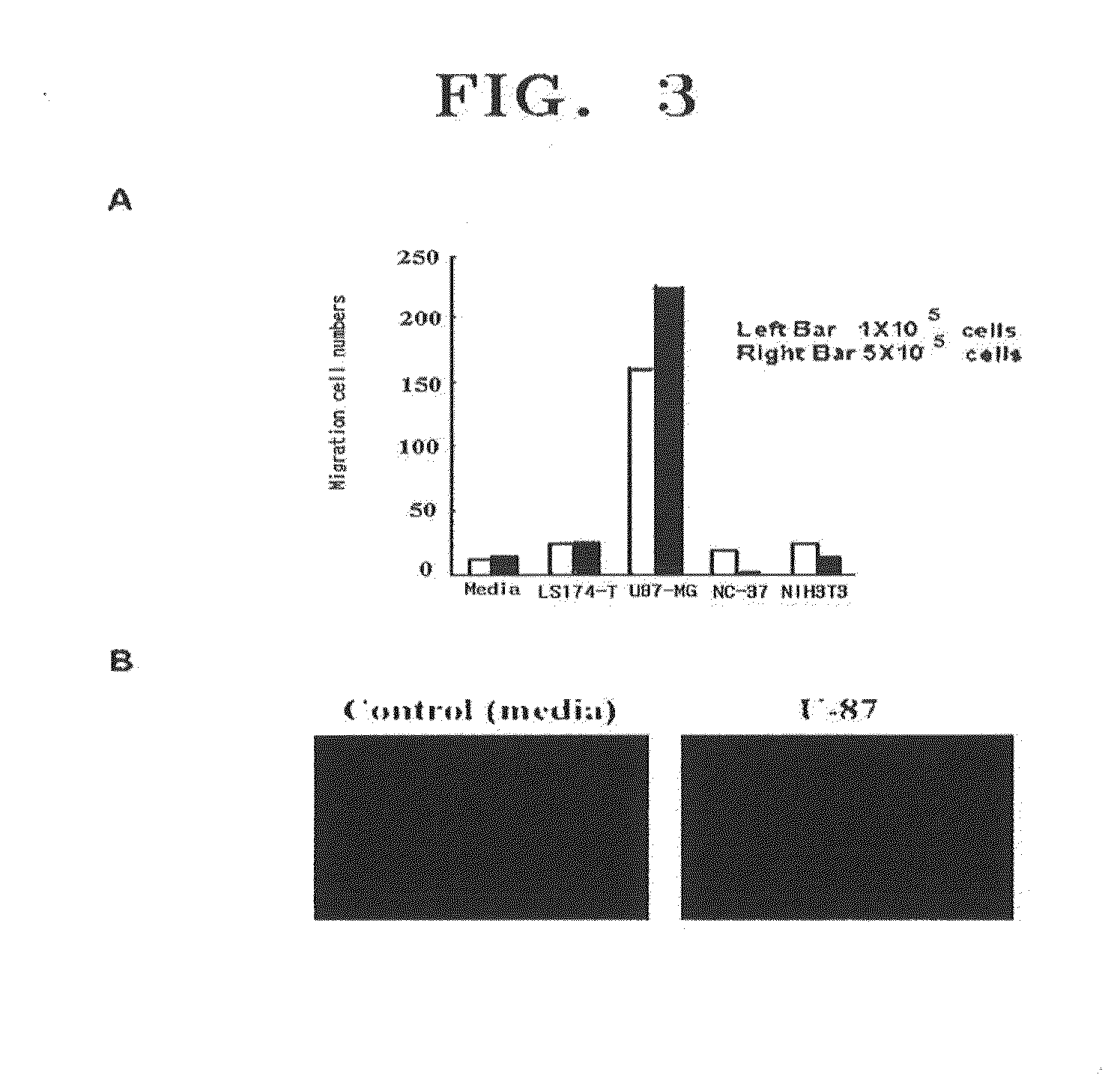 COMPOSITION FOR THE DIAGNOSIS, PREVENTION OR TREATMENT OF DISEASES RELATED TO CELLS EXPRESSING IL-8 OR GRO-ALPHA, COMPRISING UCB-MSCs