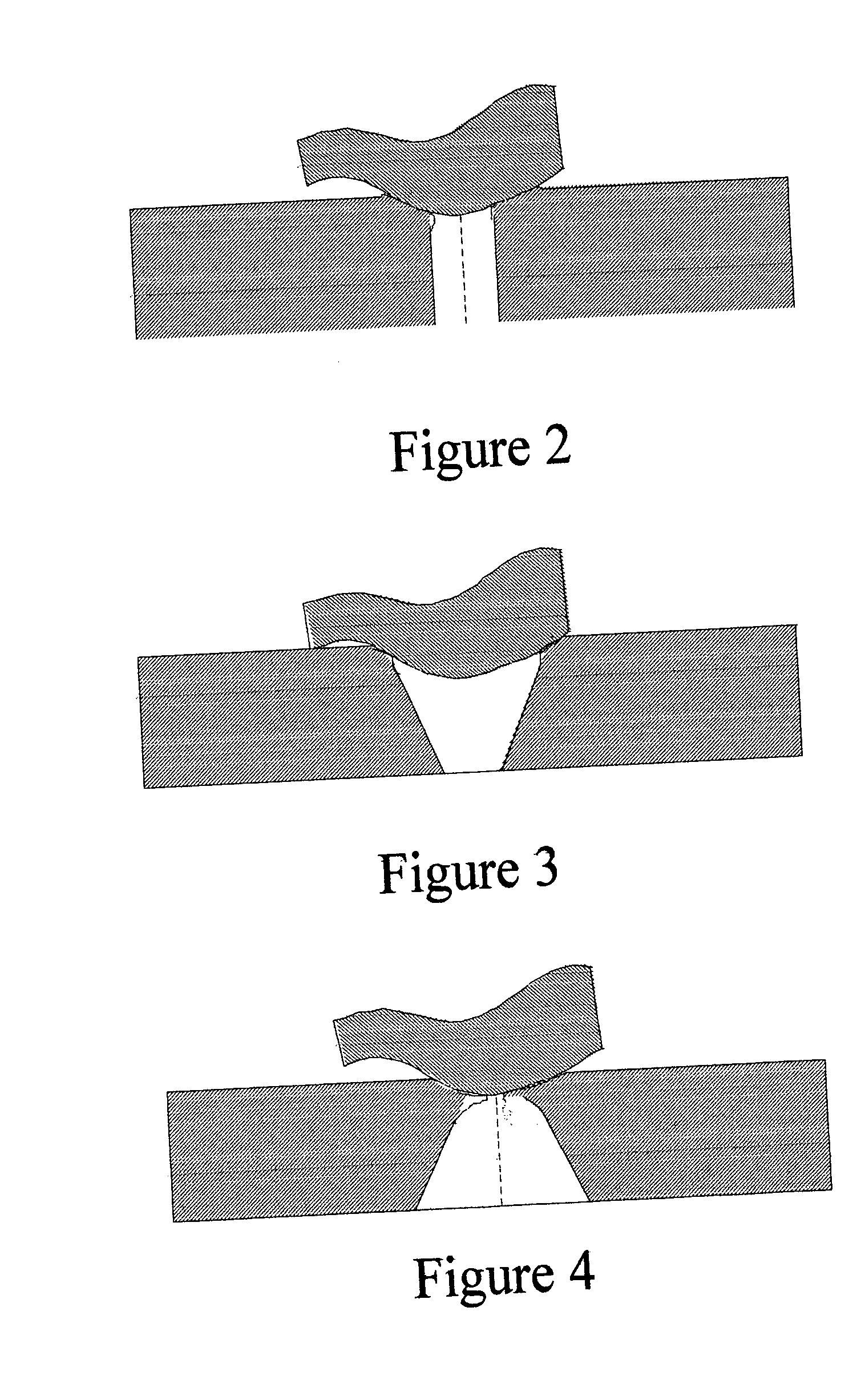 Methods and devices for reducing stress concentration when supporting a body