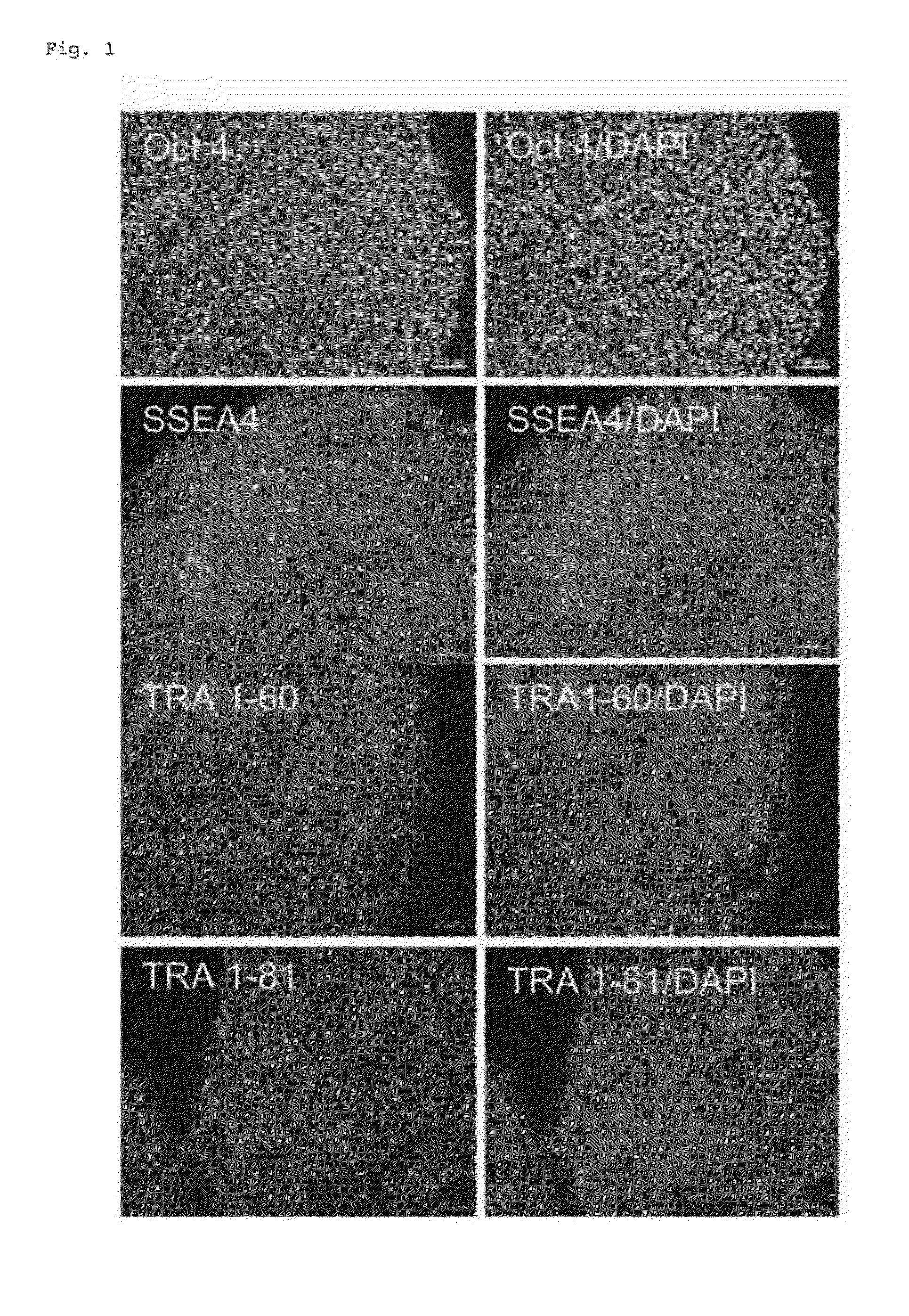 Mature hepatocyte cells derived from induced pluripotent stem cells, a generating method thereof, and use thereof for treatment of liver diseases