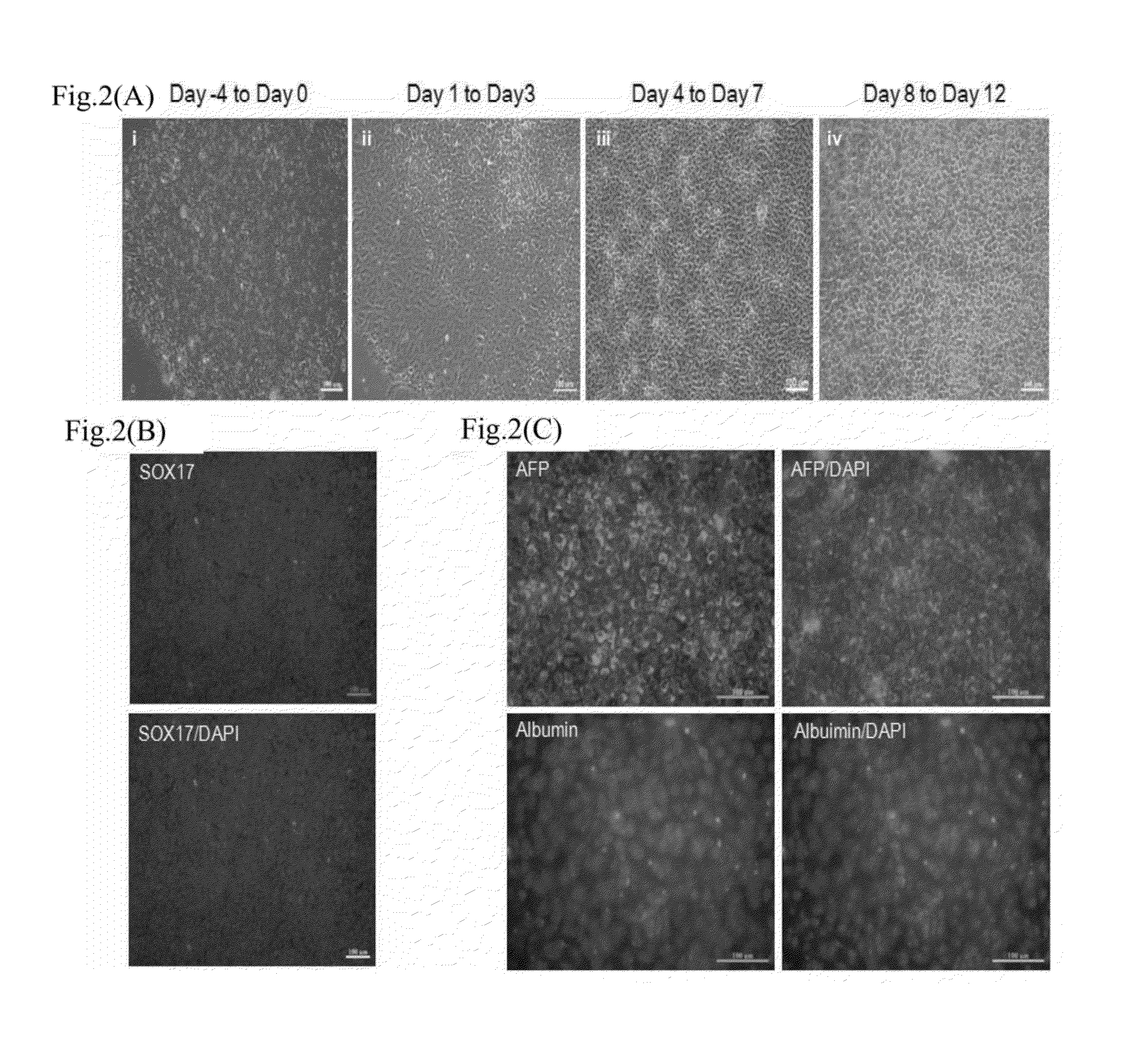 Mature hepatocyte cells derived from induced pluripotent stem cells, a generating method thereof, and use thereof for treatment of liver diseases
