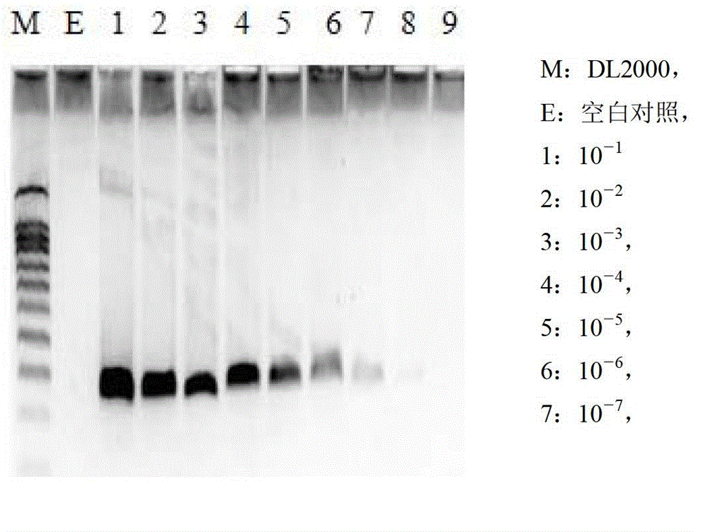 Vibrio parahaemolyticus detection primer set and detection method
