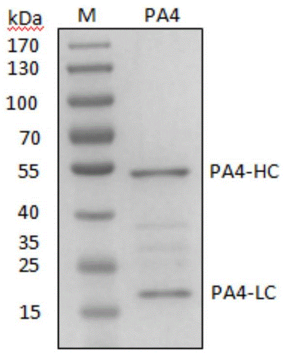 Variable region gene of full human monoclonal antibody specific to pro-protein convertase subtilisin/kexin 9 (PCSK9) and application thereof