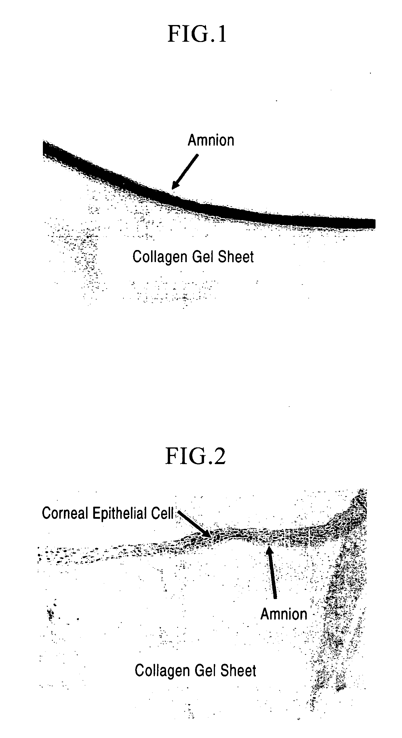 Medical Material and Process for Producing the Same