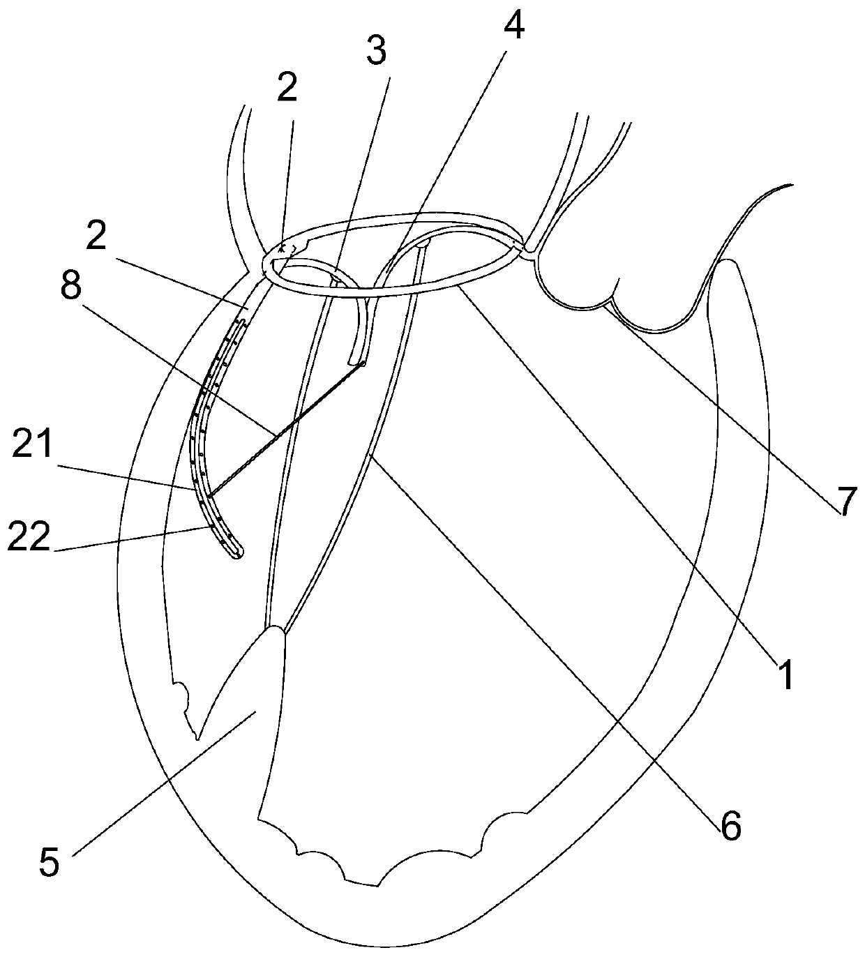 Multifunctional mitral valve shaping device