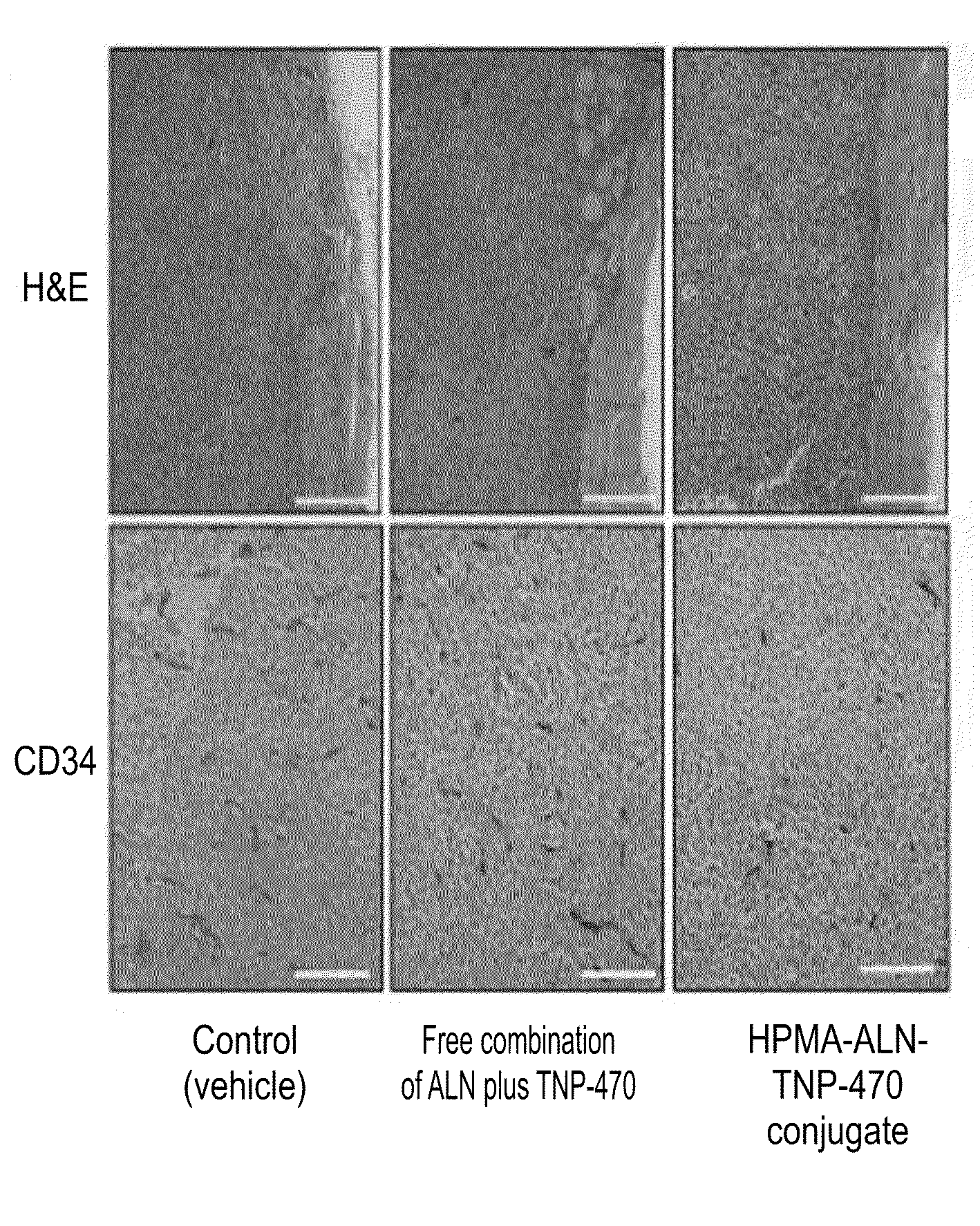 Conjugate of a polymer, an Anti-angiogenesis agent and a targeting moiety, and uses thereof in the treatment of bone related angiogenesis conditions