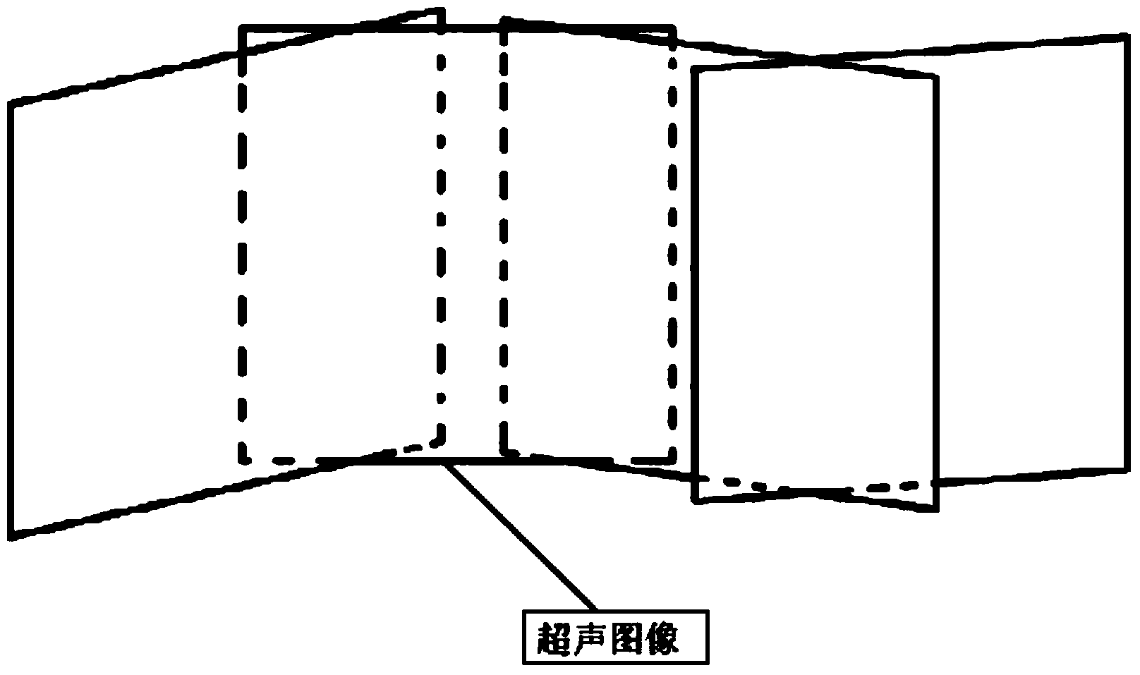 Position information based ultrasonic wide view imaging method