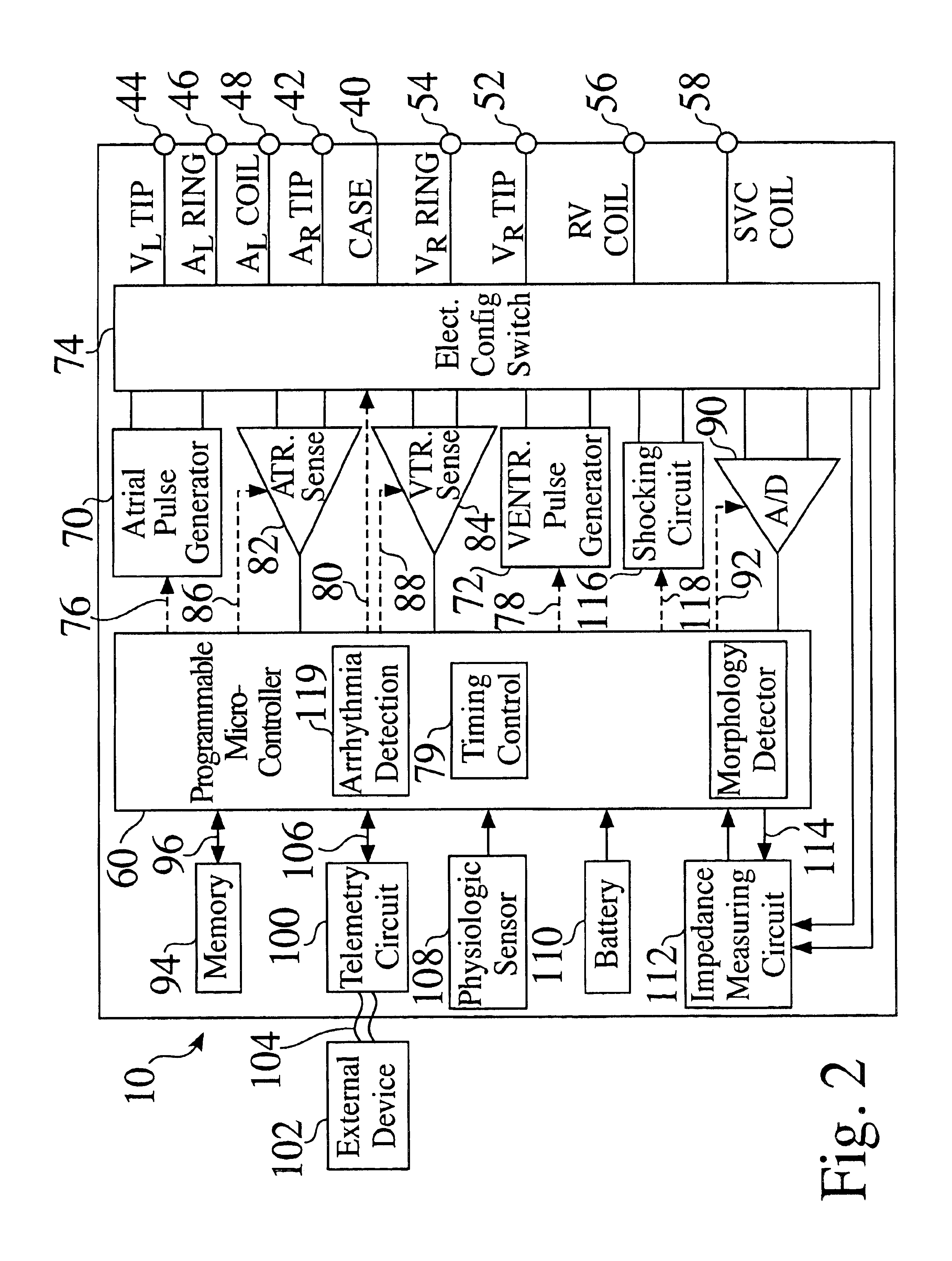Methods and devices for inhibiting battery voltage delays in an implantable cardiac device