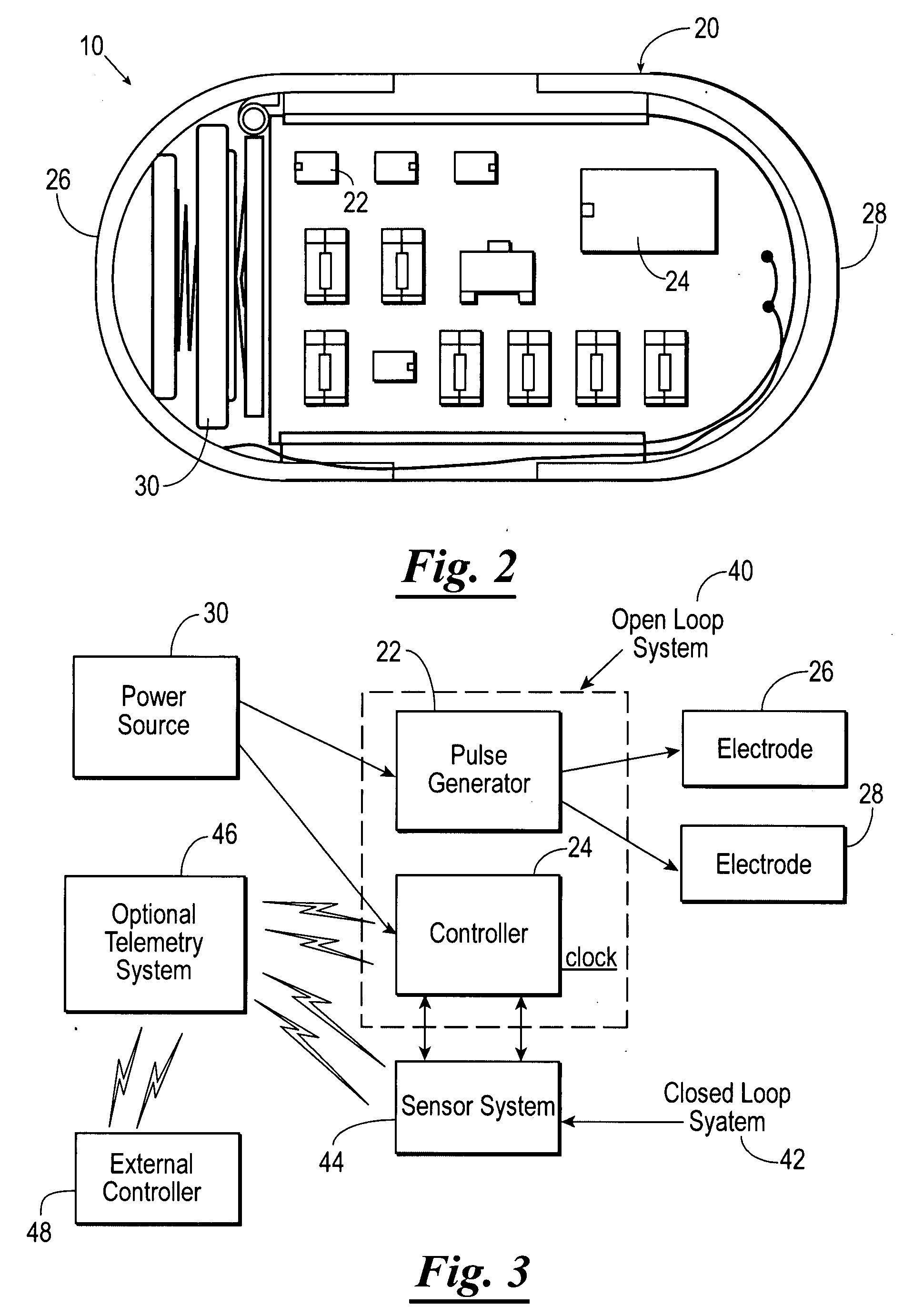 Gastrointestinal stimulator device for digestive and eating disorders