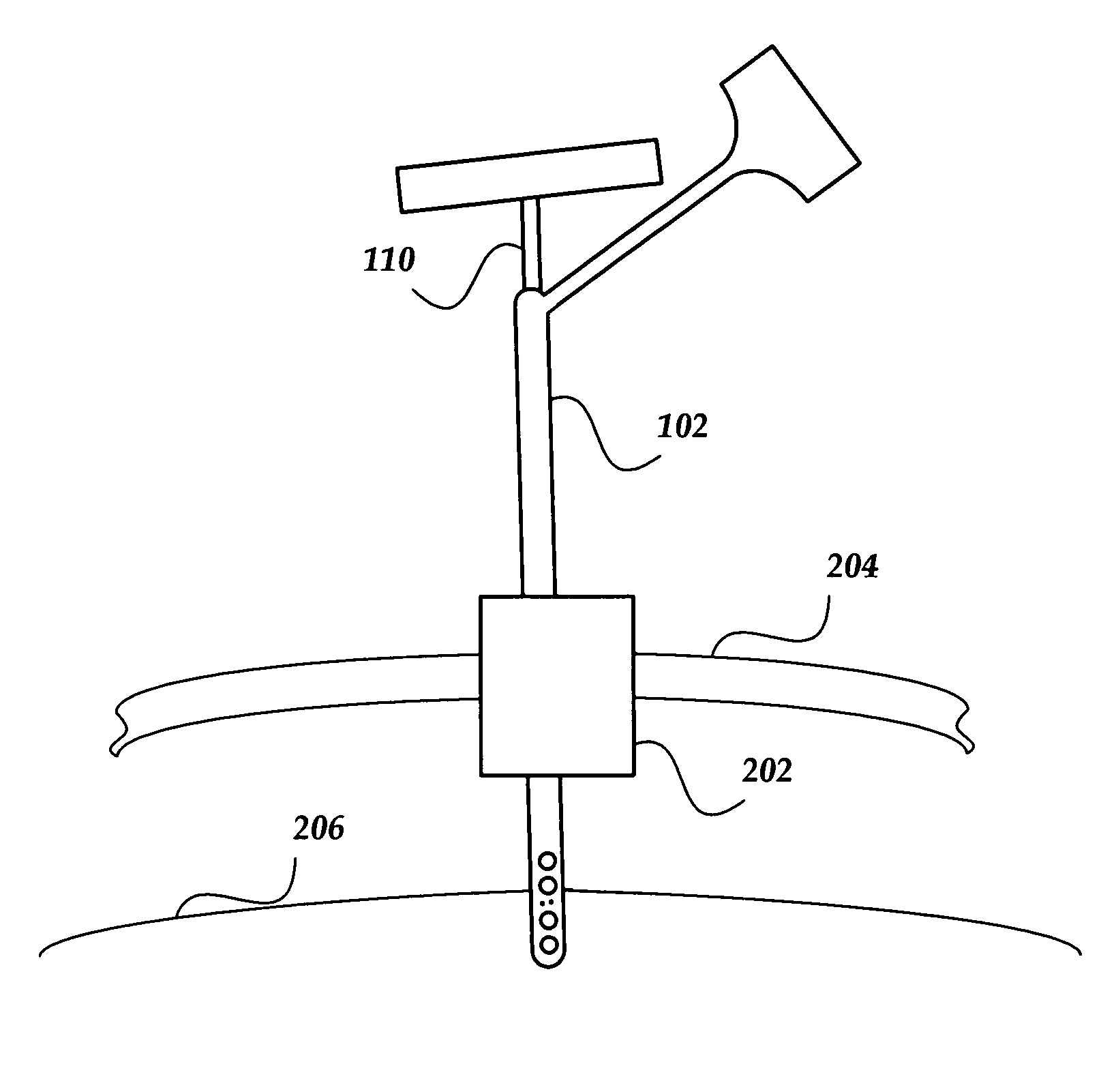 Devices and methods using an implantable pulse generator for brain stimulation