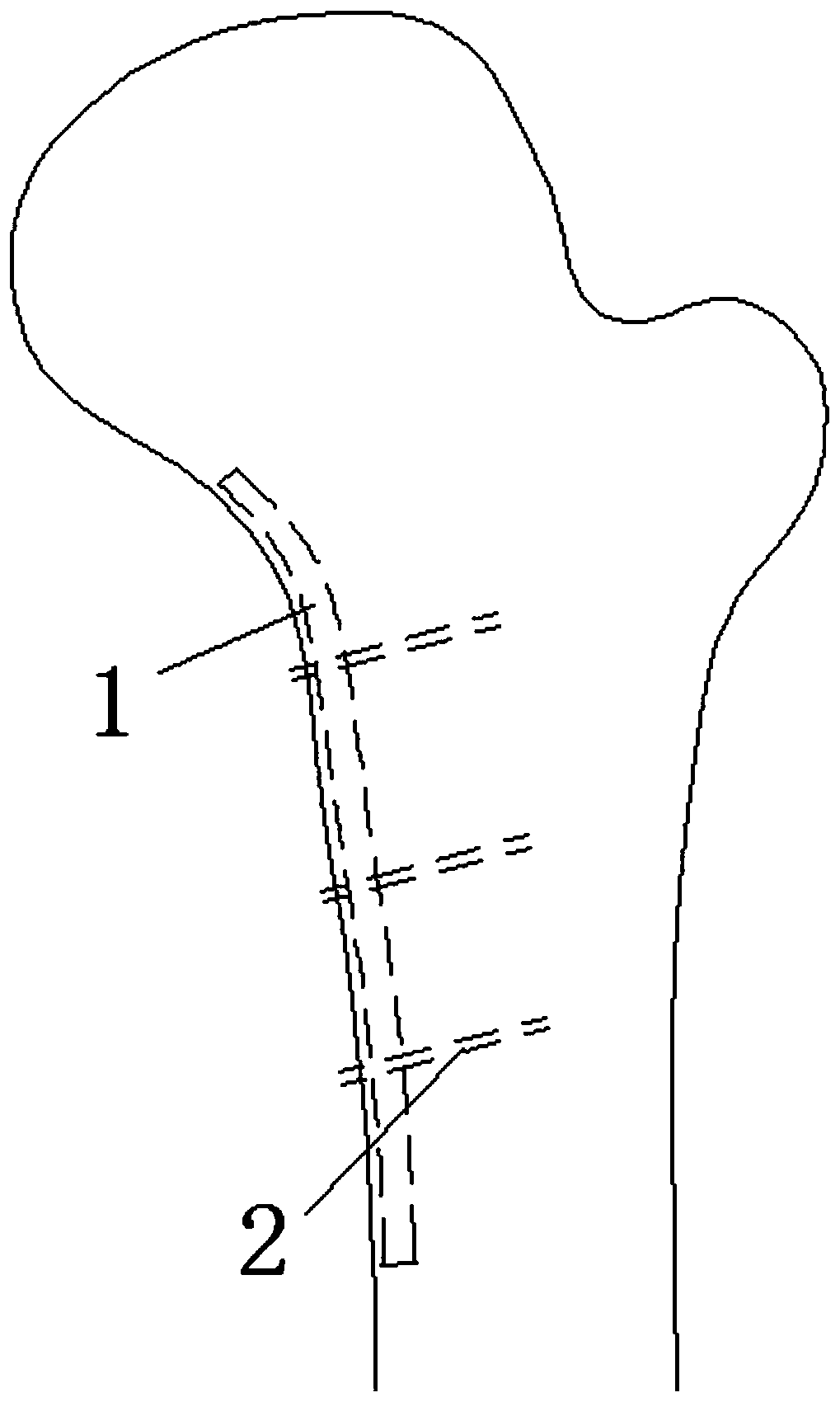 Inside support structure for medullary cavity suitable for strengthening internal fixation for proximal femoral fracture
