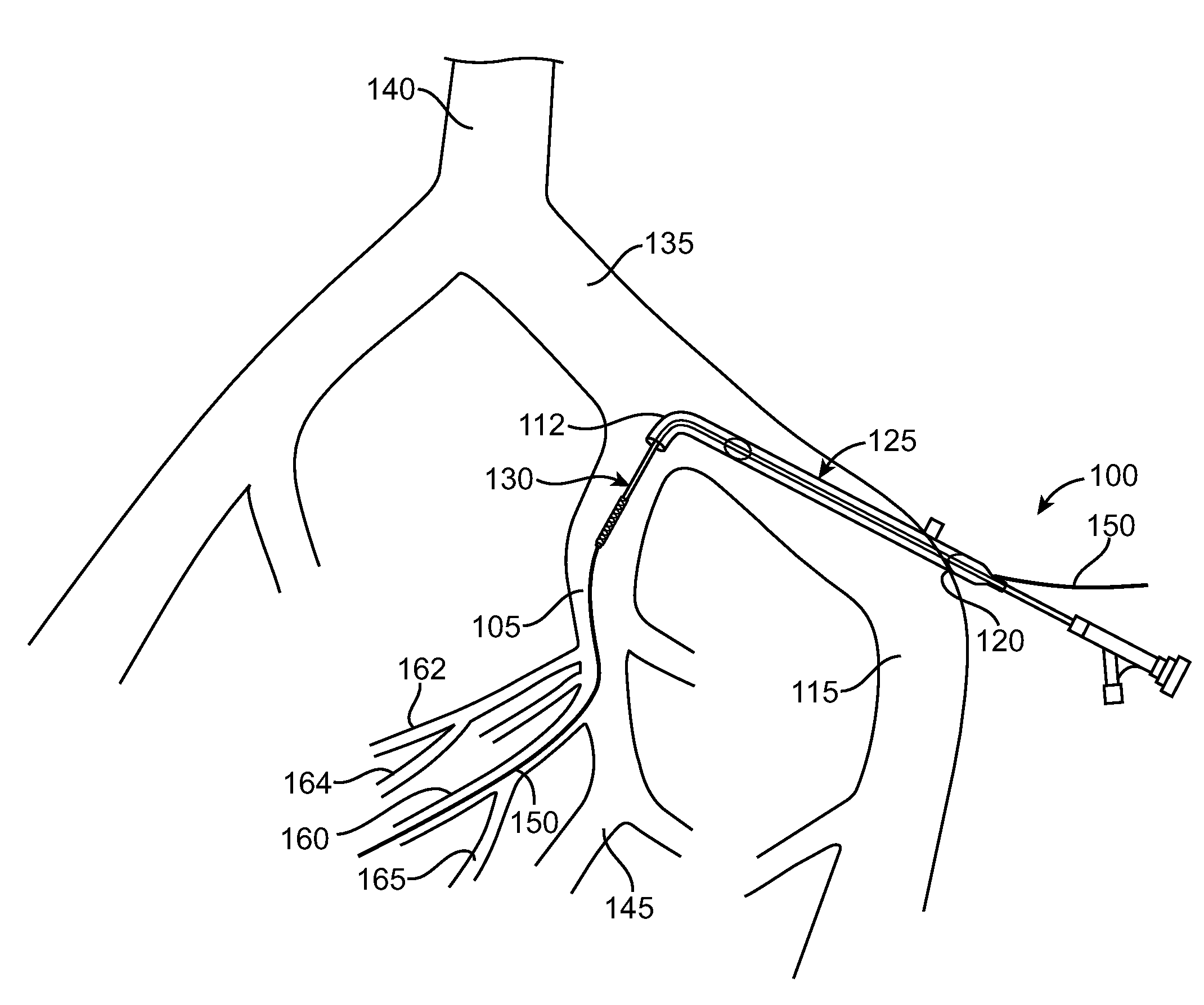 Method of Diagnosing and Treating Lower Urinary Tract Symptoms