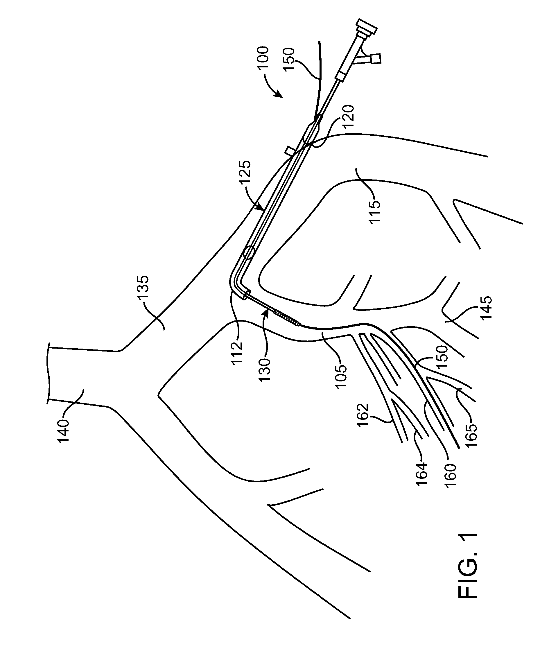 Method of Diagnosing and Treating Lower Urinary Tract Symptoms