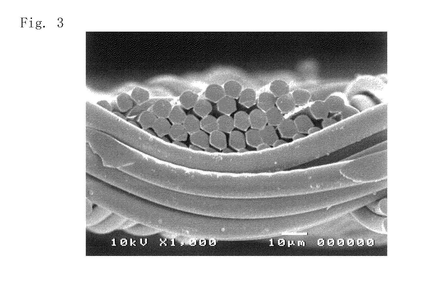 Base fabric for stent graft, and stent graft