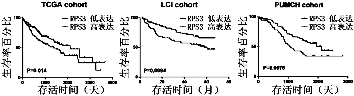 Biomarker in diagnosis of liver cancer and kit containing biomarker in diagnosis of liver cancer