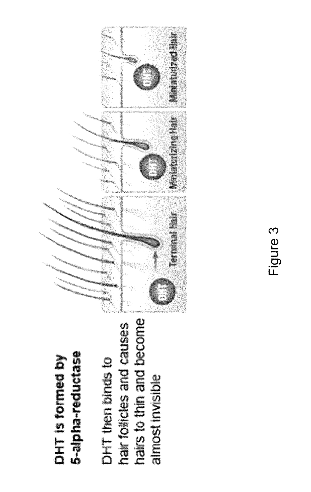 Hair loss prevention and restoration solution