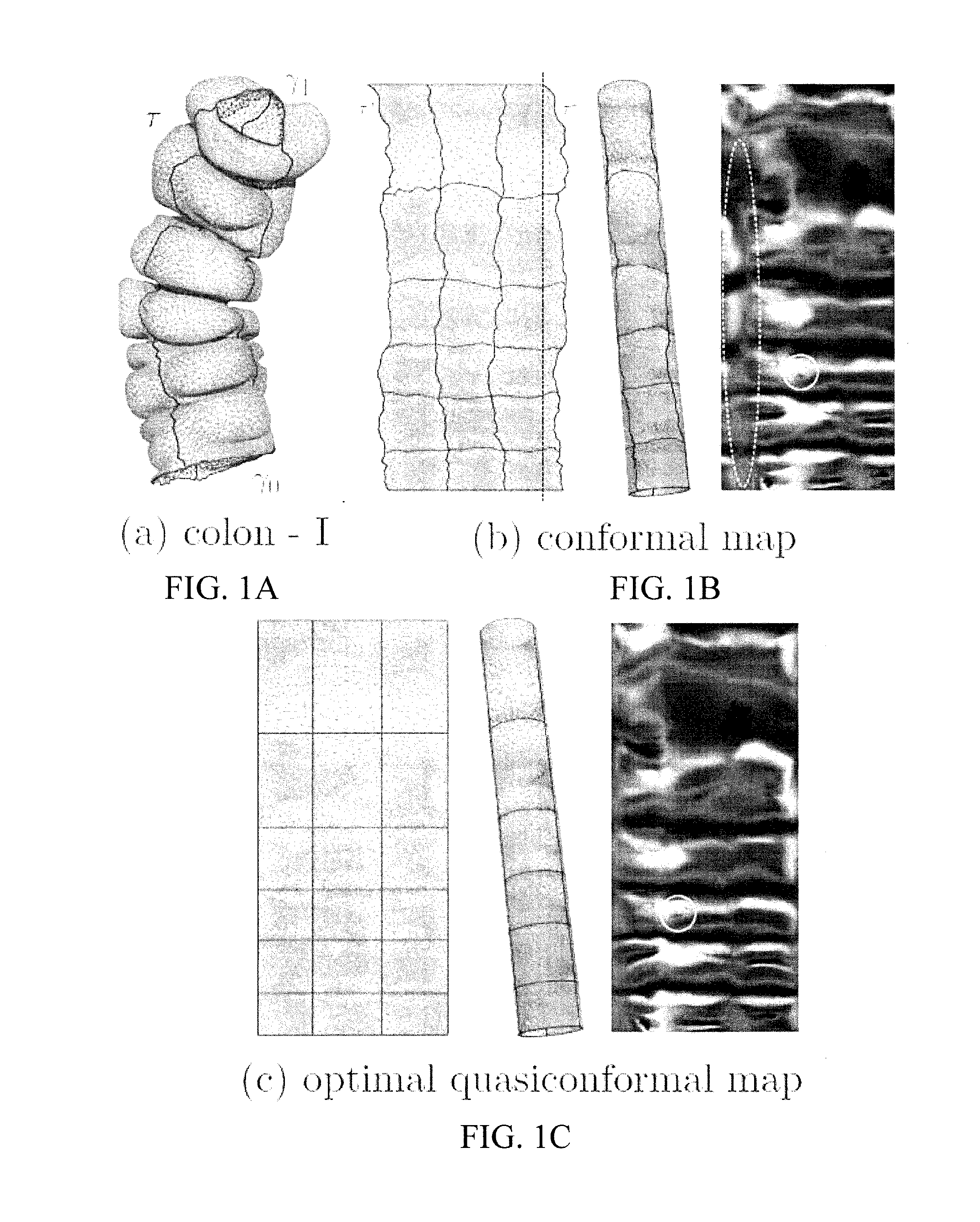 Systems and methods for shape analysis using landmark-driven quasiconformal mapping