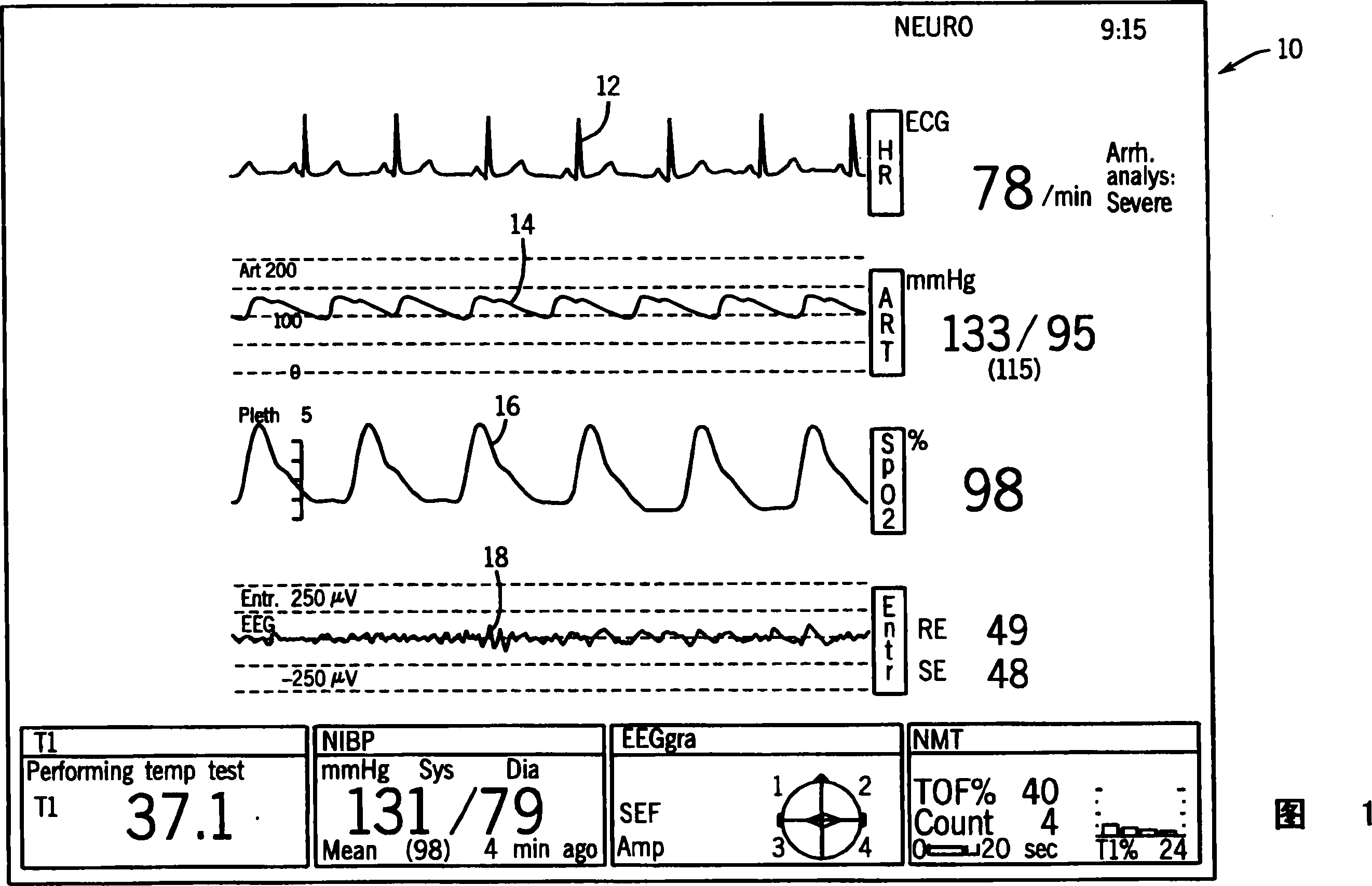 Integrated anesthesia monitoring and ultrasound display