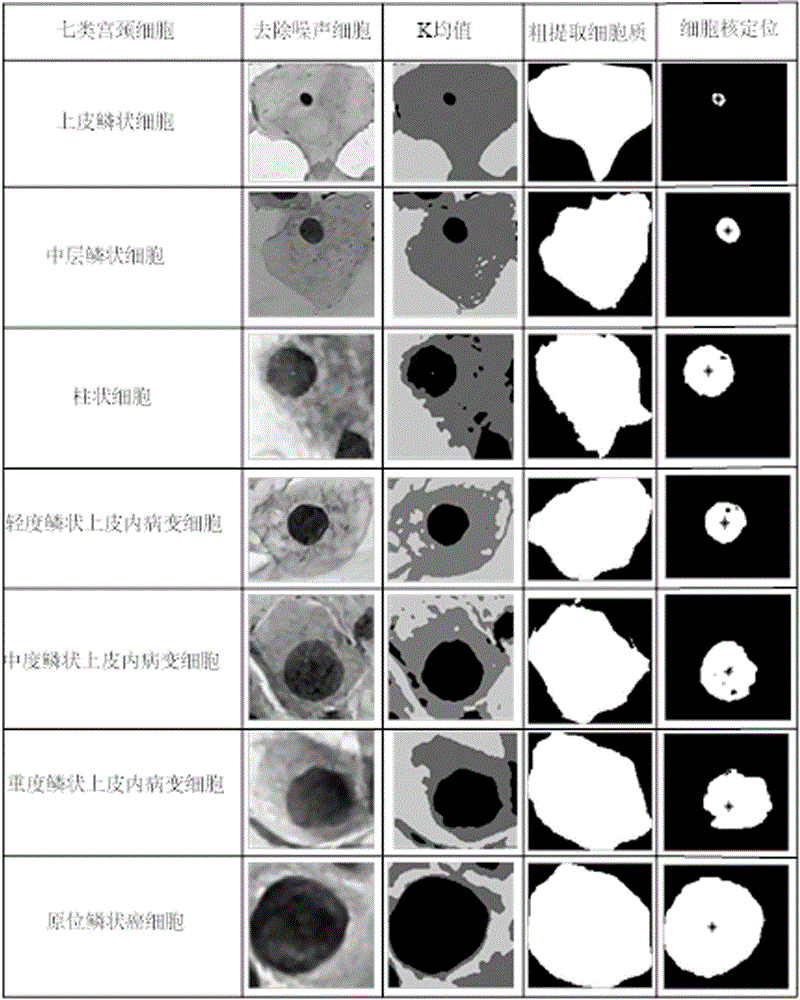 Cervix uteri single cell image segmentation algorithm