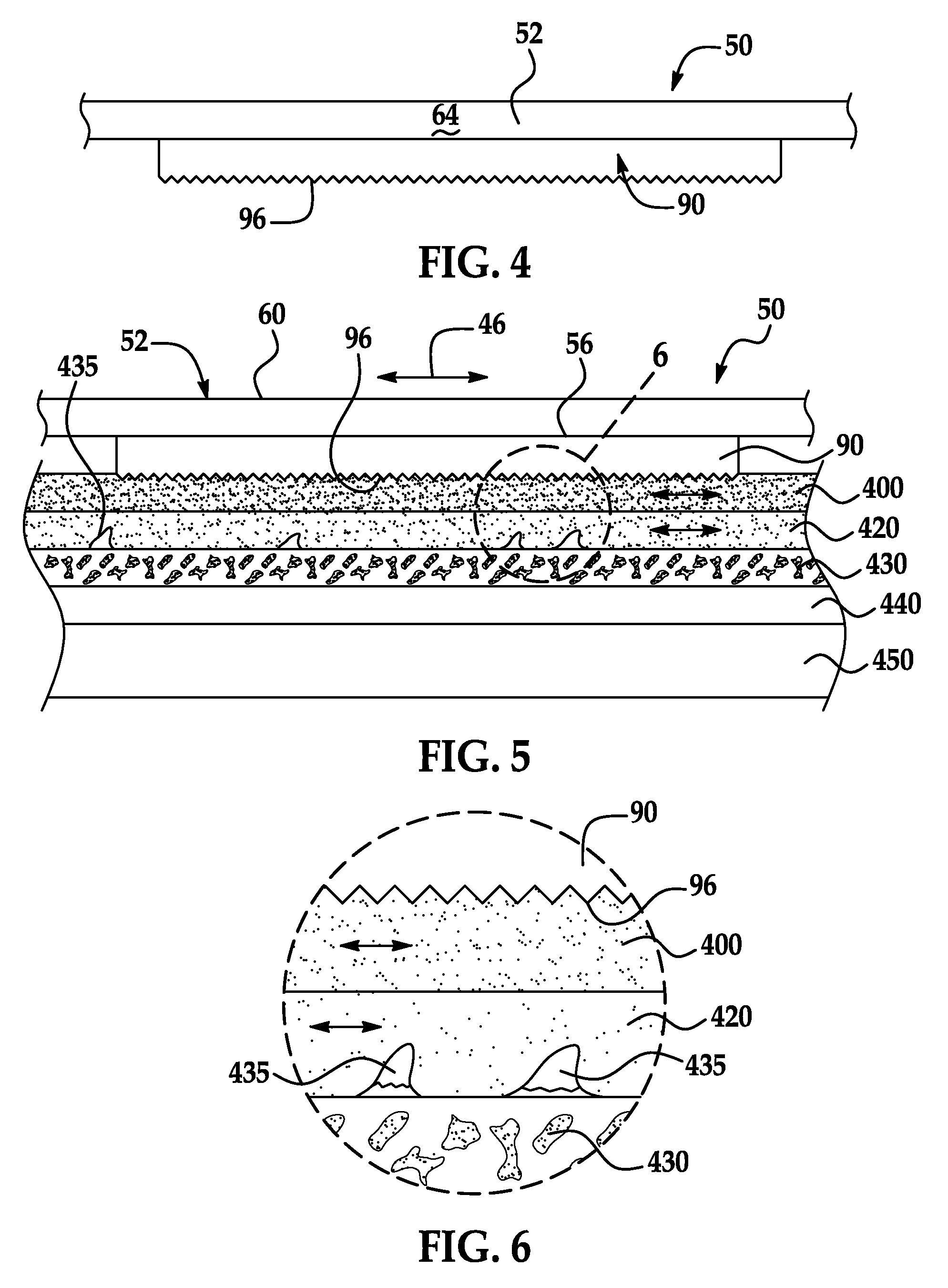 Cellulite appearance reduction apparatus and method