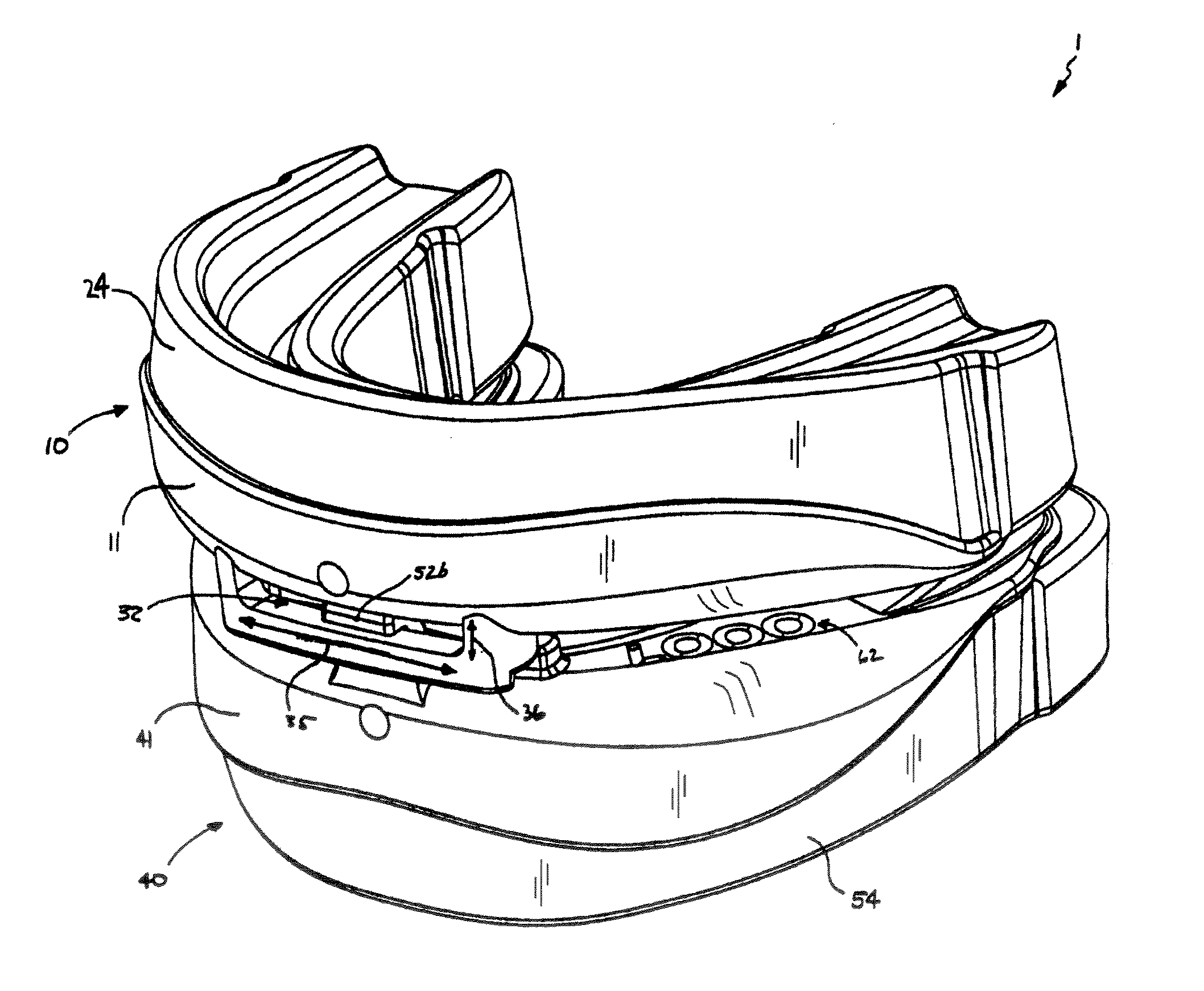 Oral appliance for treatment of snoring and sleep apnea