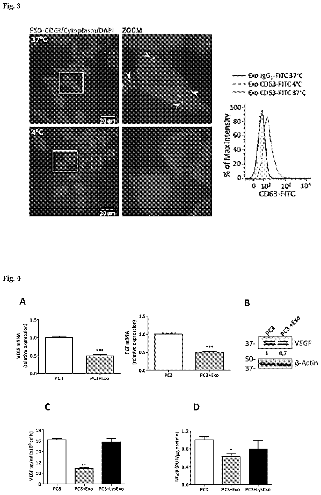 Anti-angiogenic therapy based on exosomes derived from menstrual stem cells