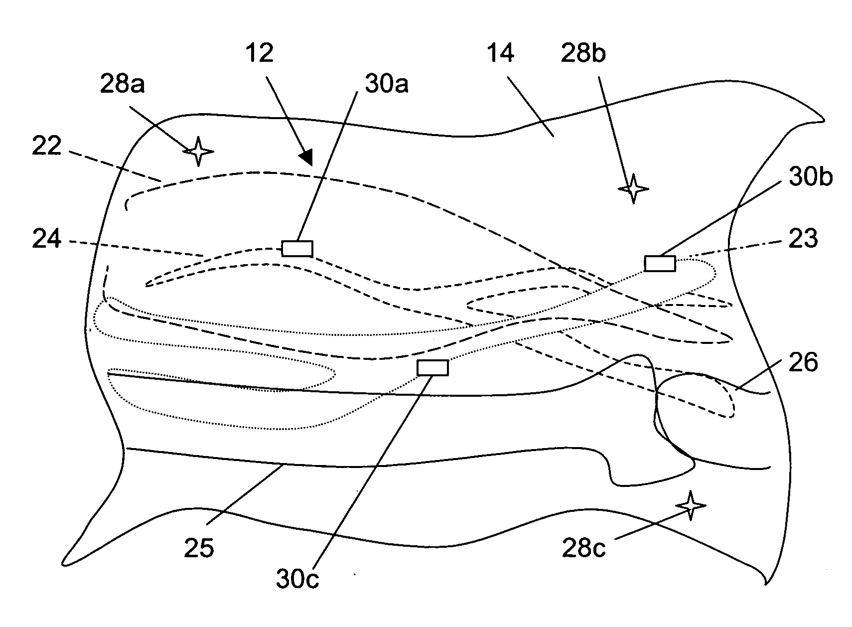 Medical method and associated apparatus utilizable in accessing internal organs through skin surface